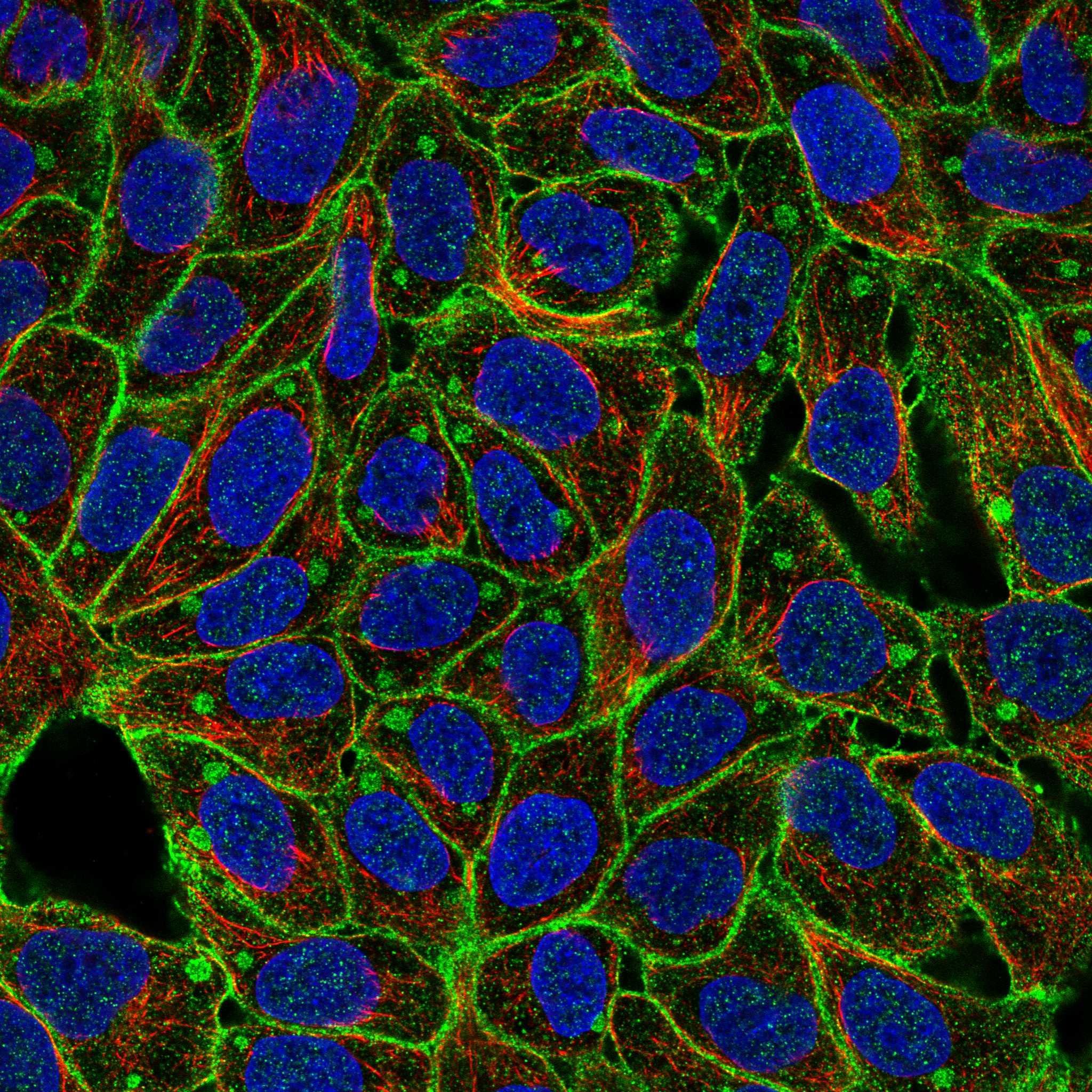 FGR fluorescence