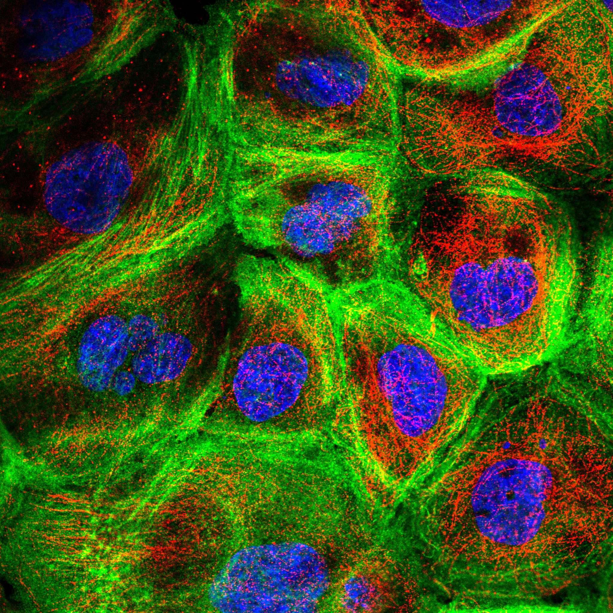 FLNA fluorescence