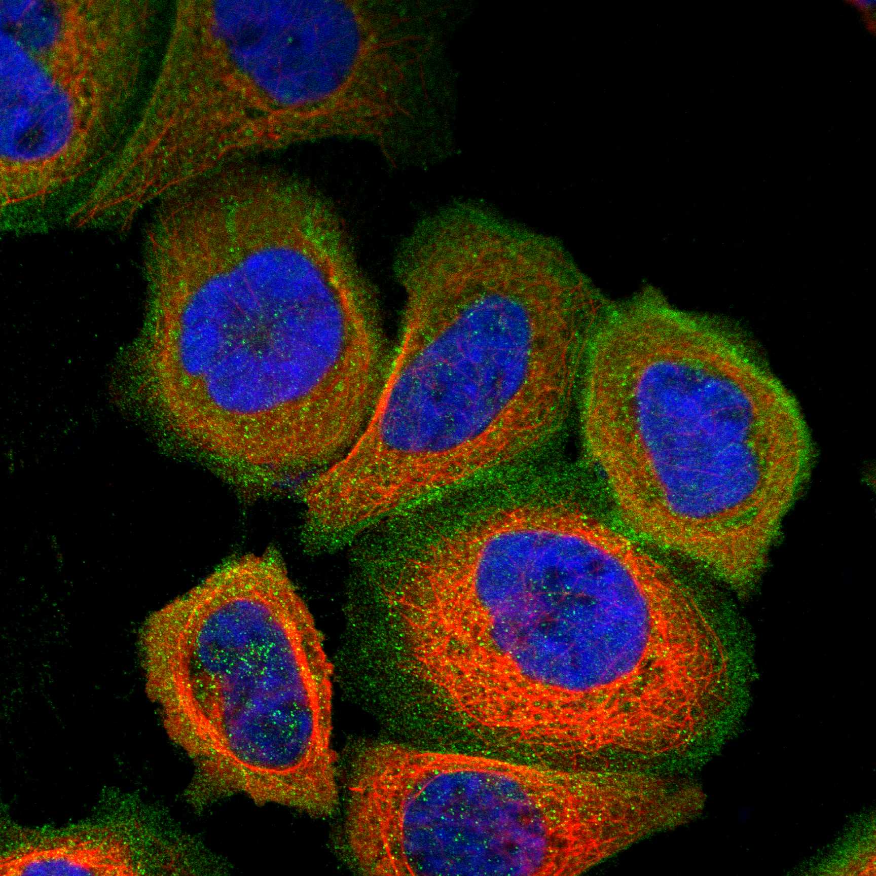 FLNB fluorescence