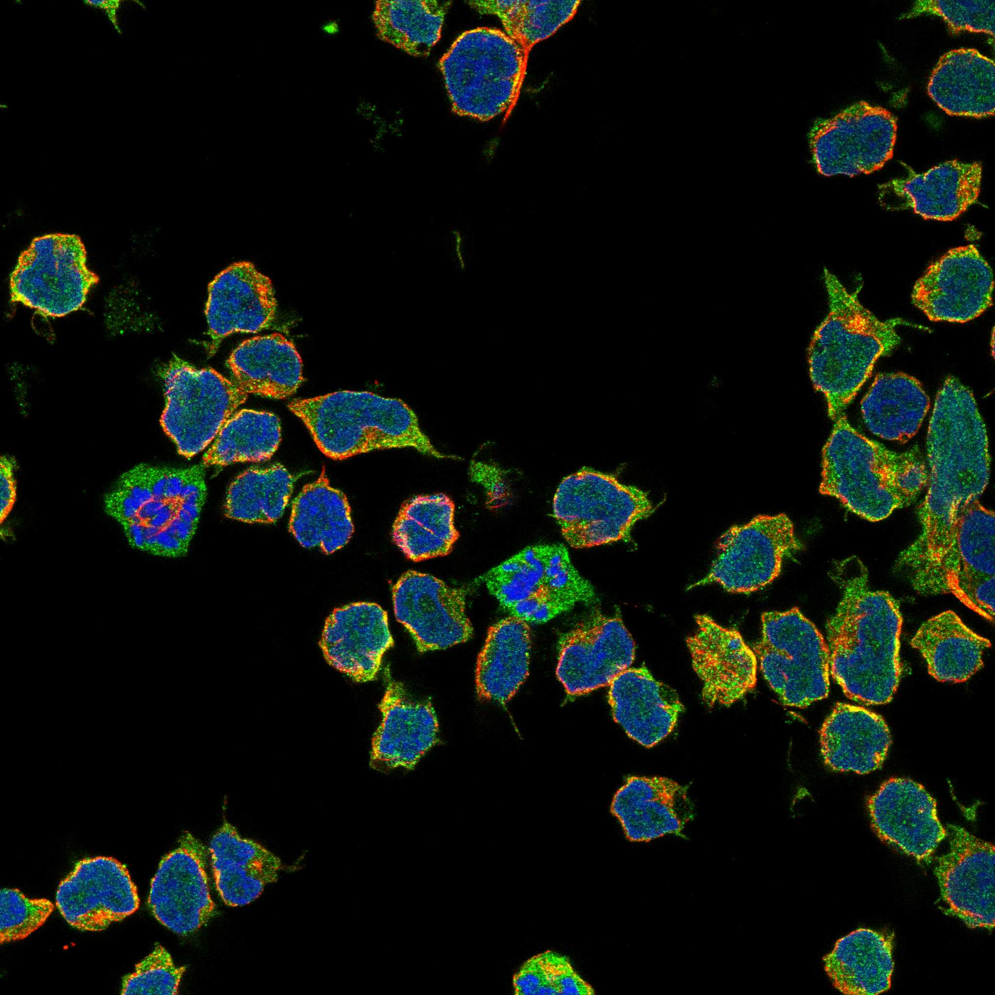 FNBP1 fluorescence