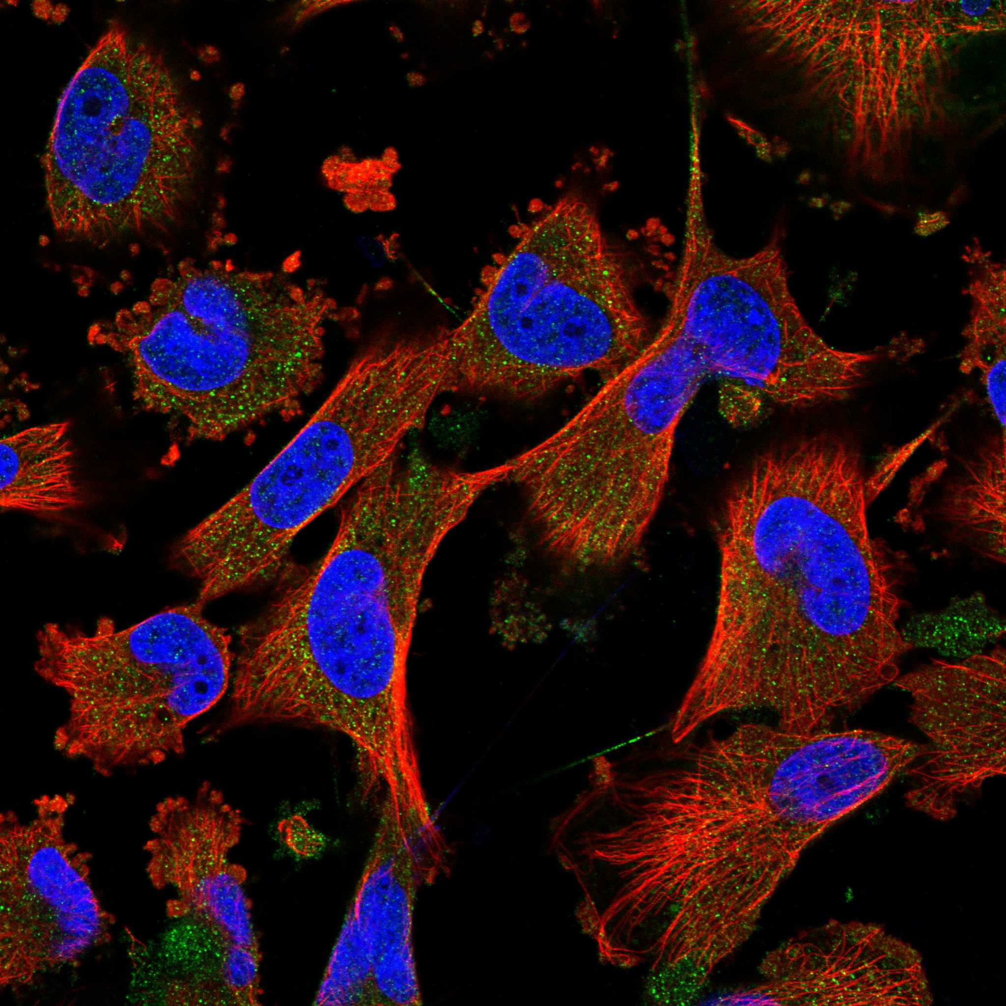 FREM2 fluorescence