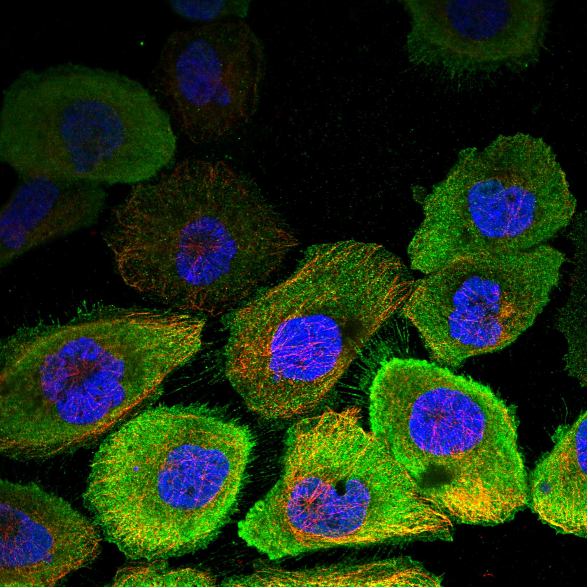 FSCN1 fluorescence