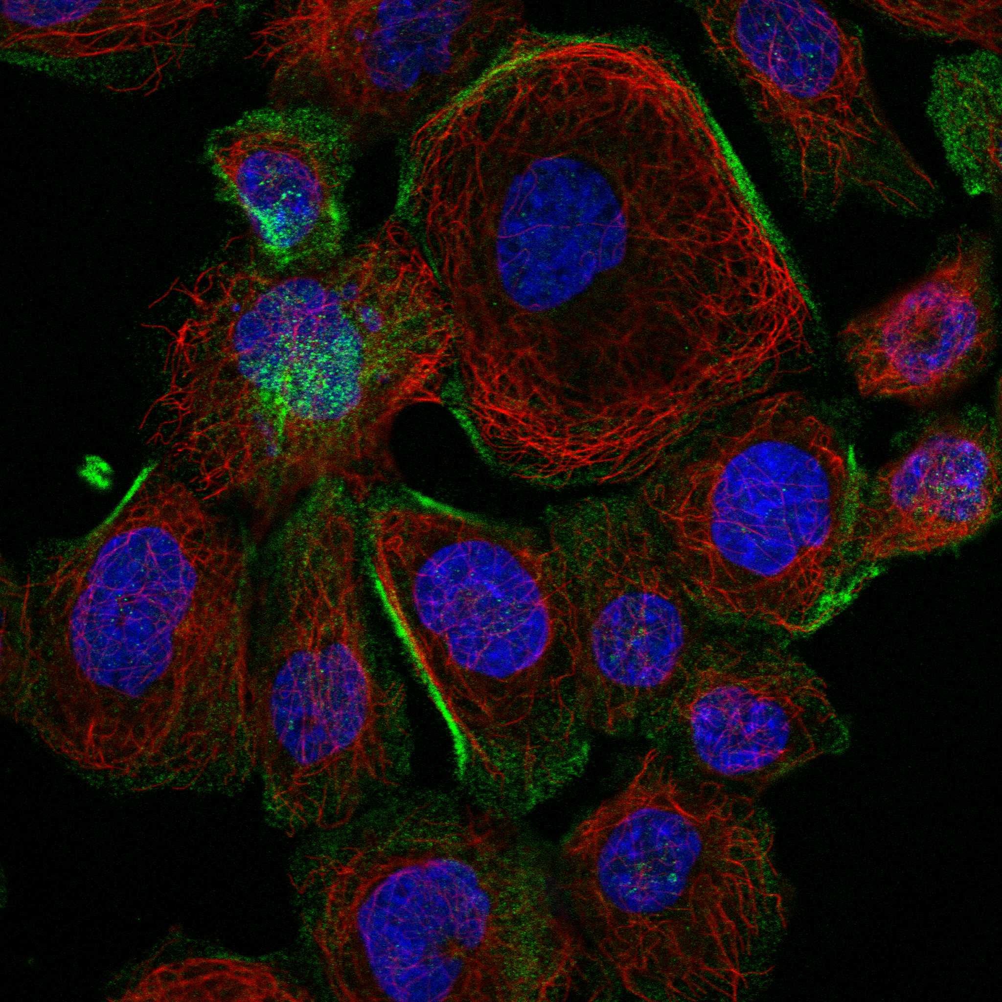 FSD1L fluorescence