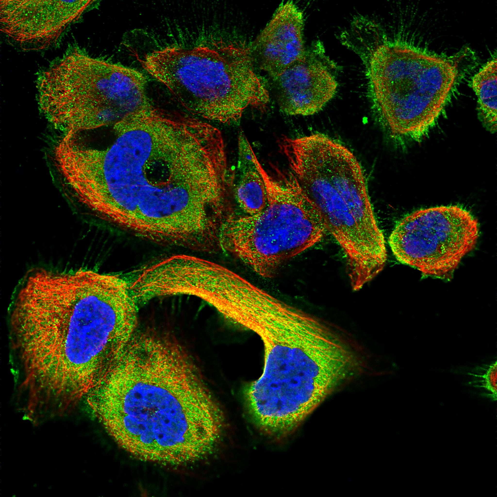 GADL1 fluorescence