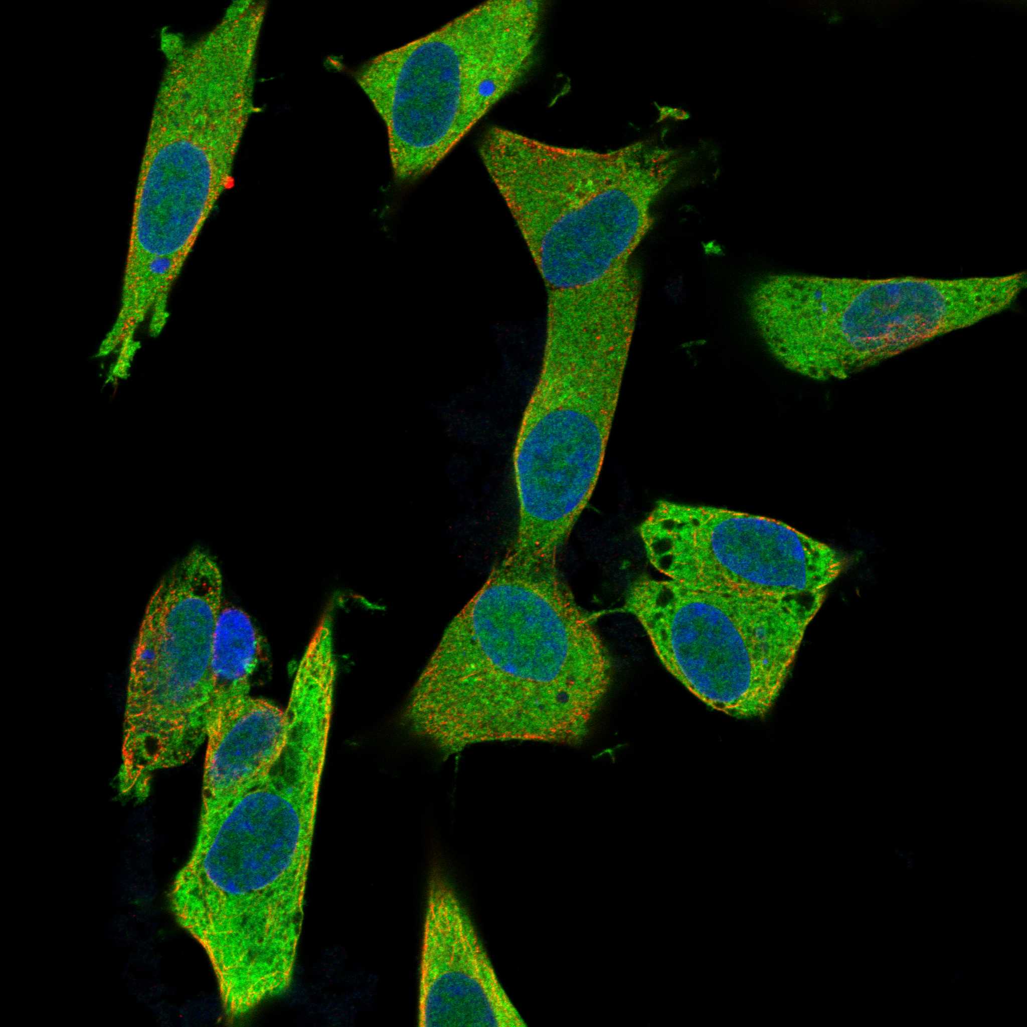 GGTA1 fluorescence