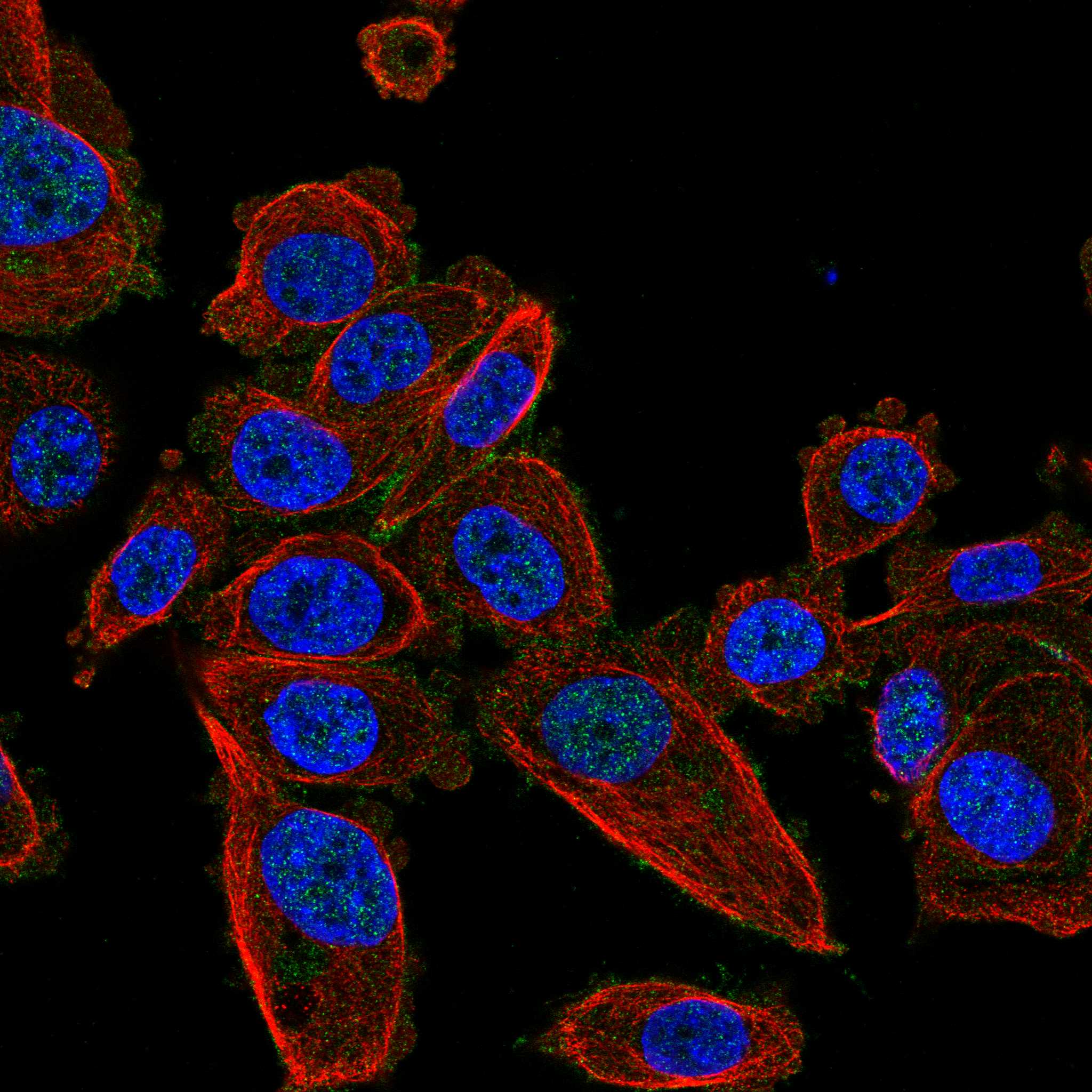 GIPC1 fluorescence