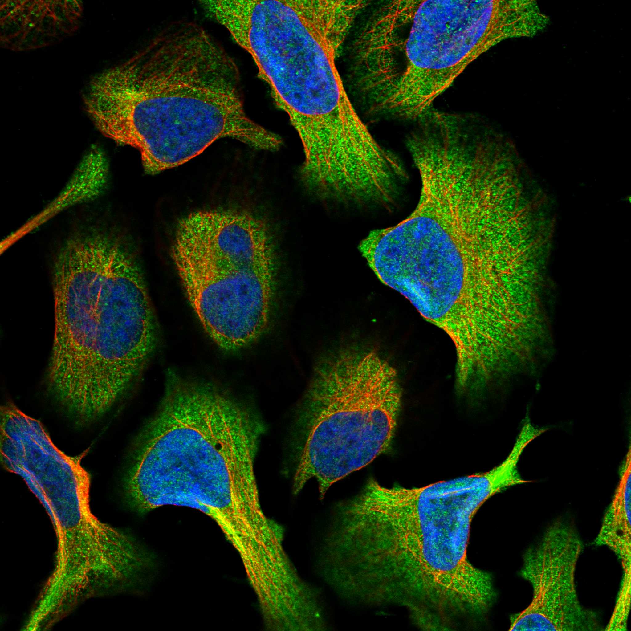 GLP2R fluorescence