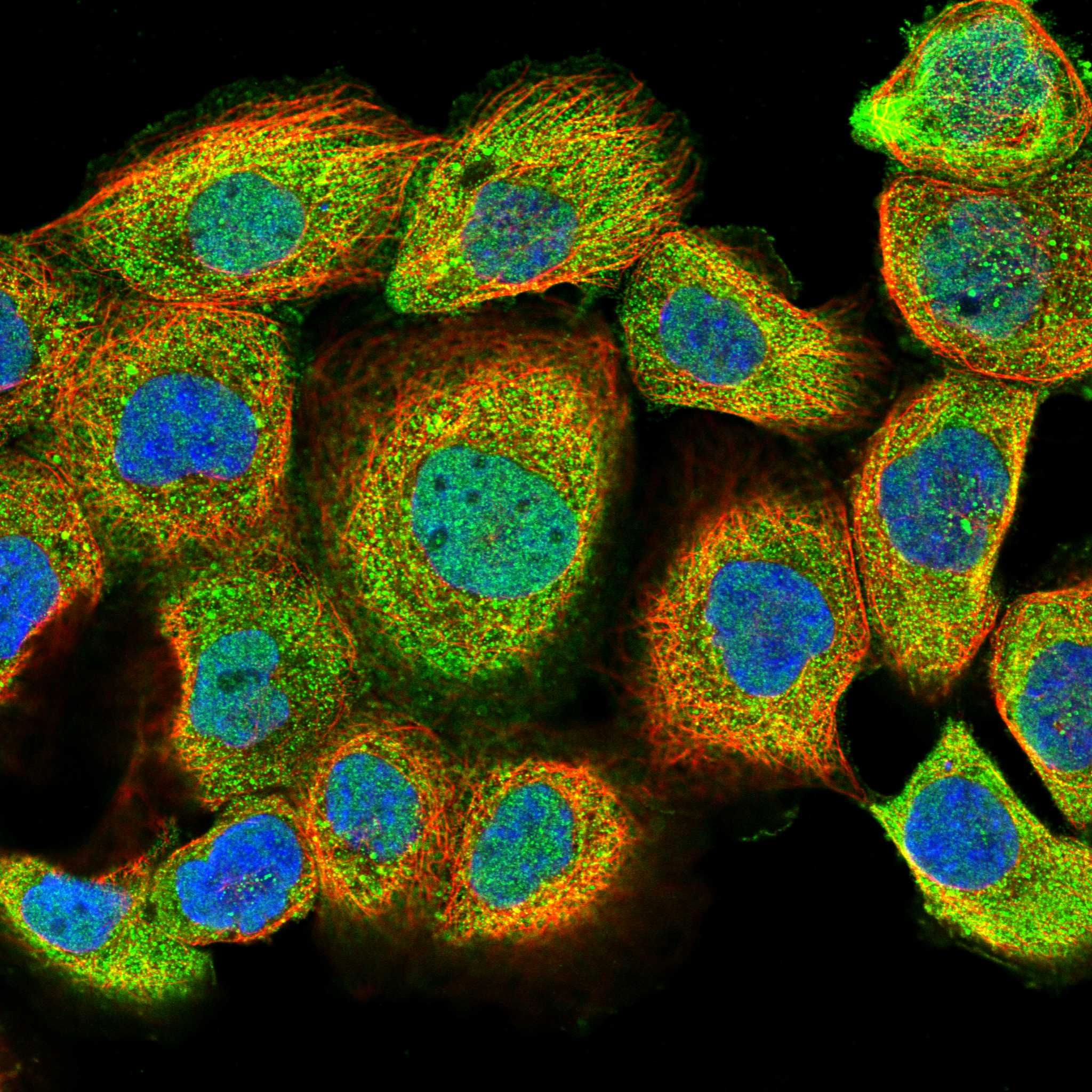 GPC1 fluorescence