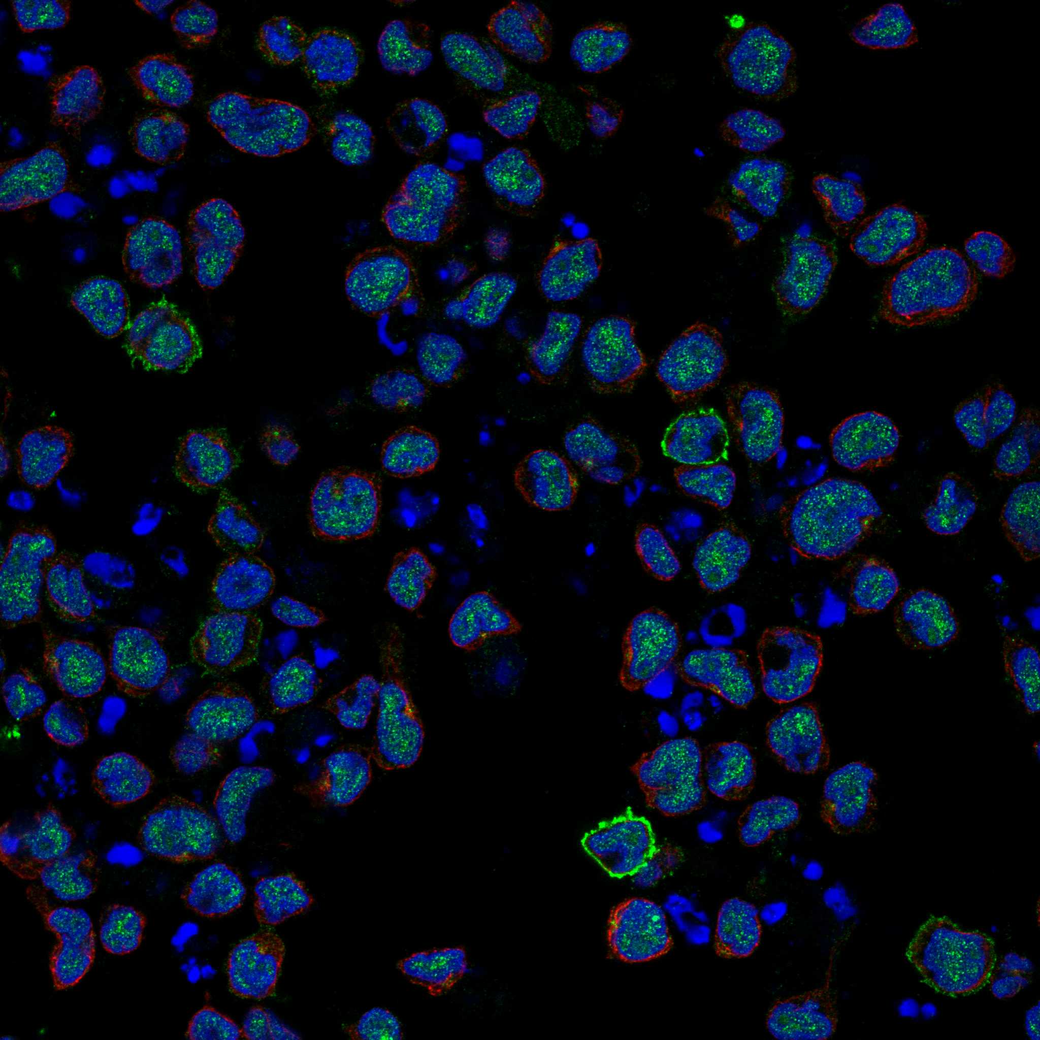 GRIK5 fluorescence