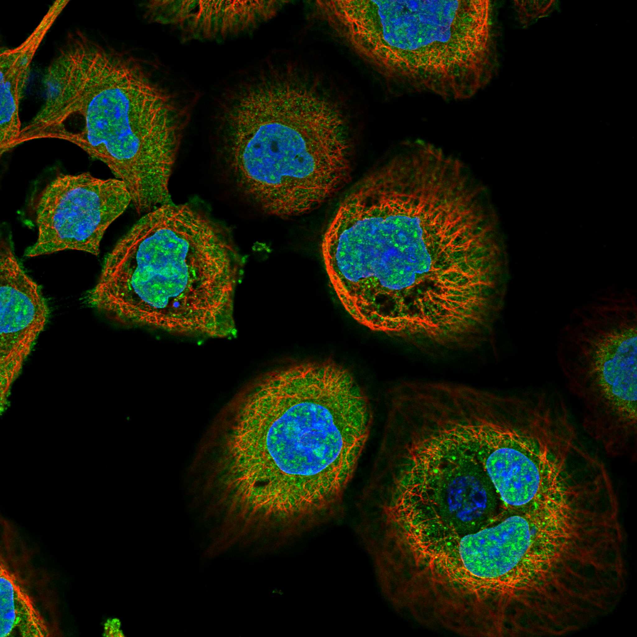 GRK5 fluorescence