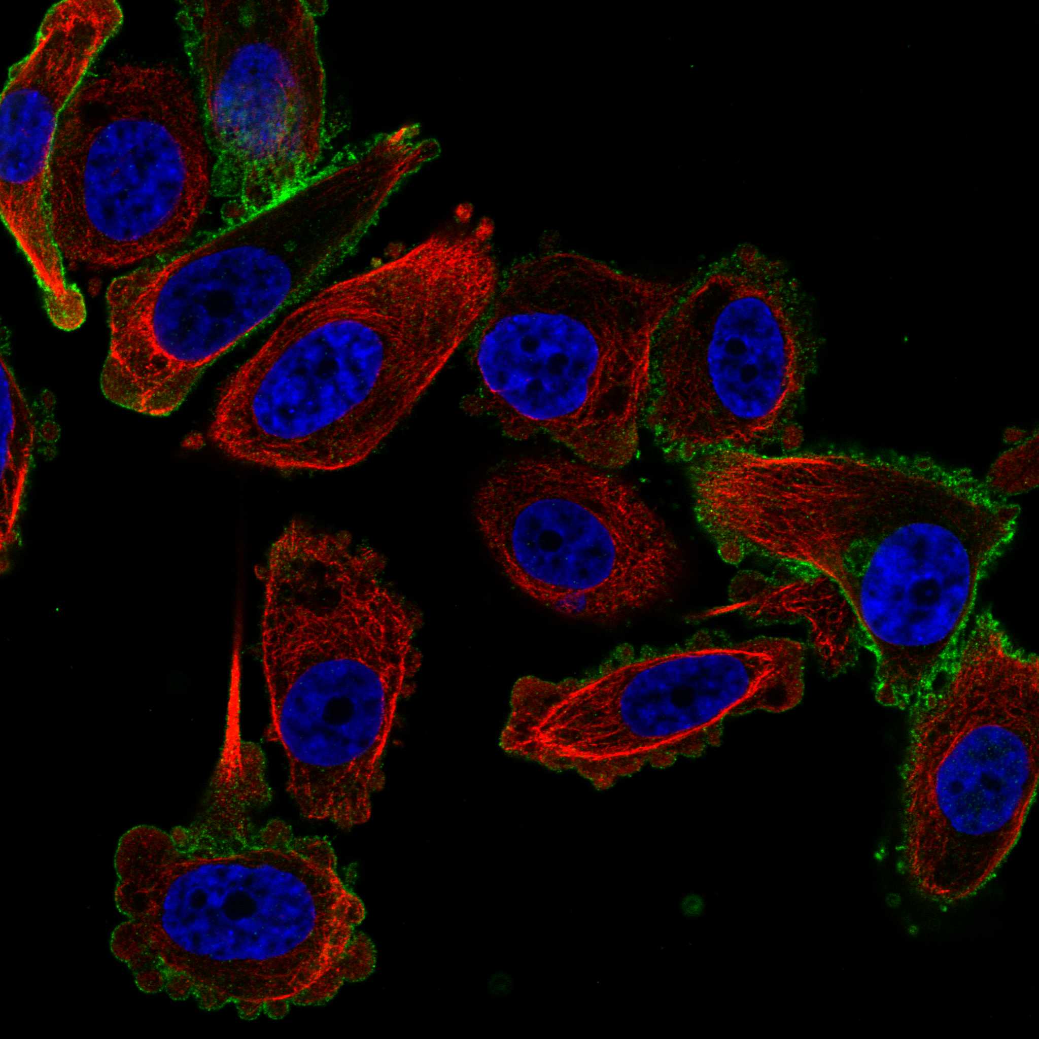 GRPR fluorescence