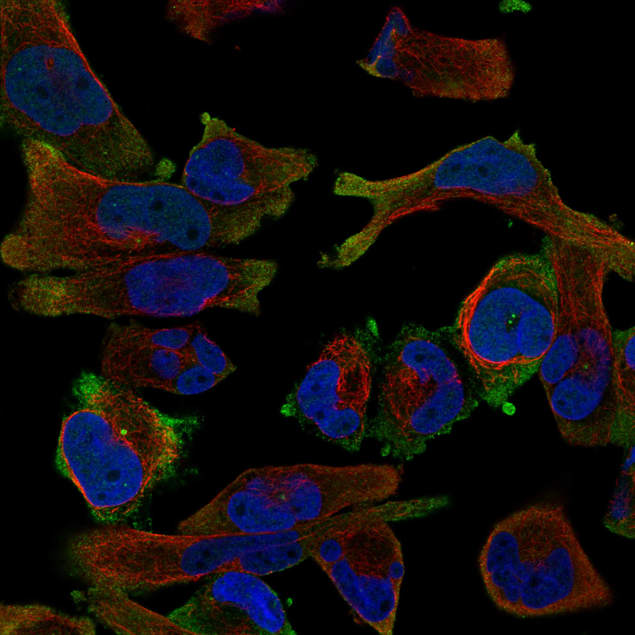 GTSE1 fluorescence