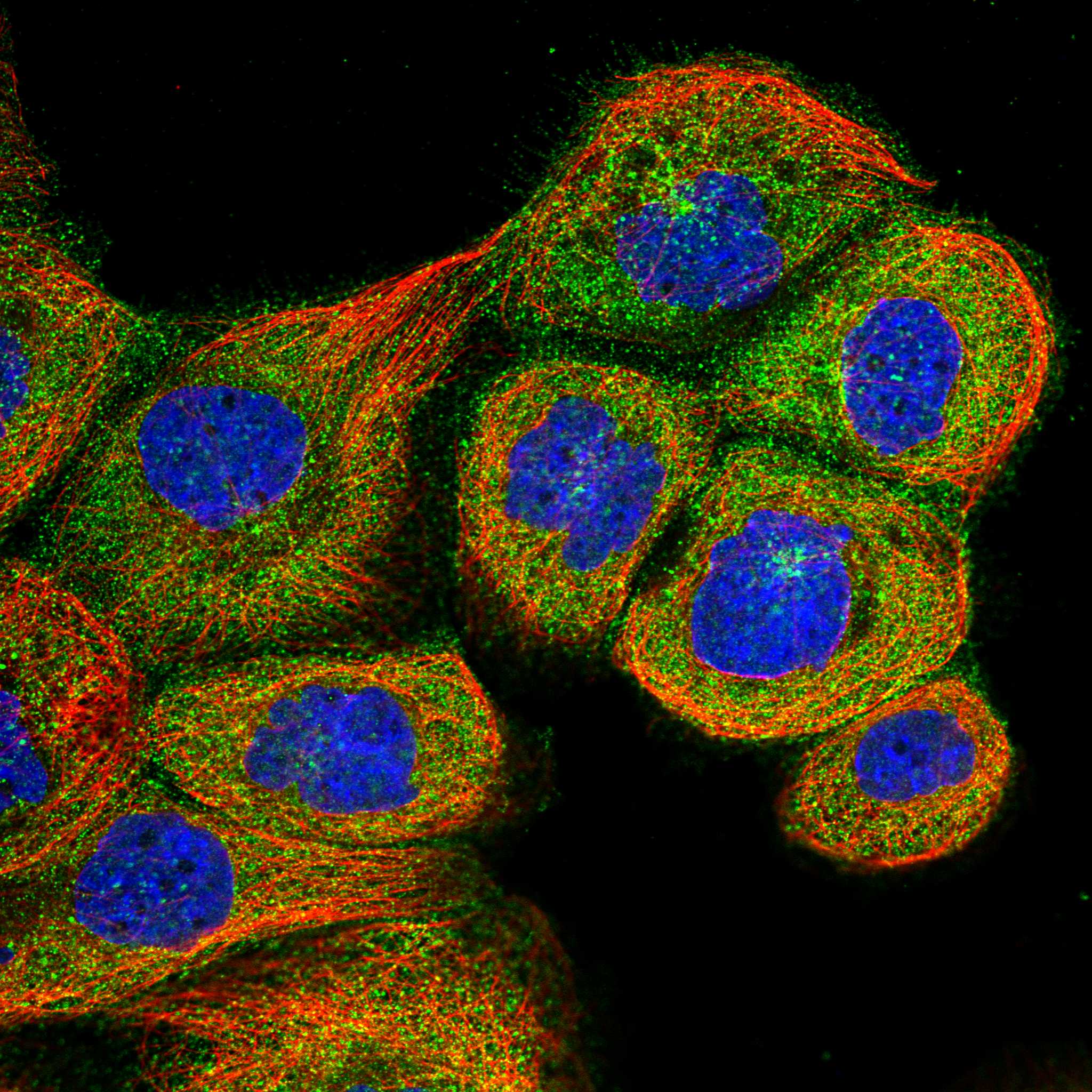HIP1R fluorescence