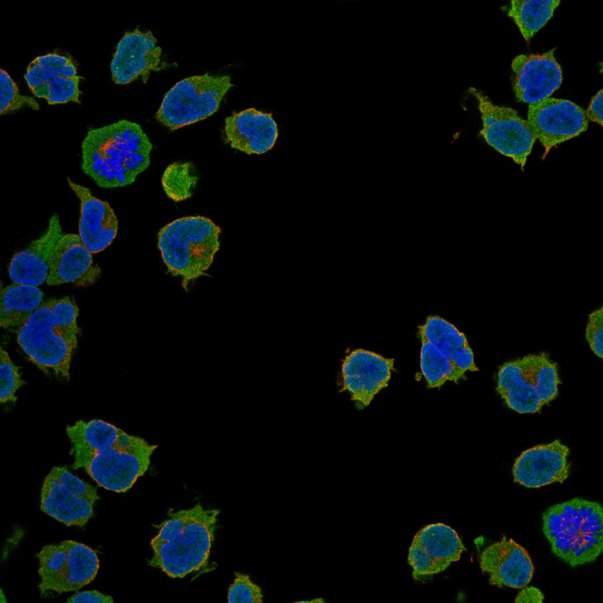 HPS4 fluorescence