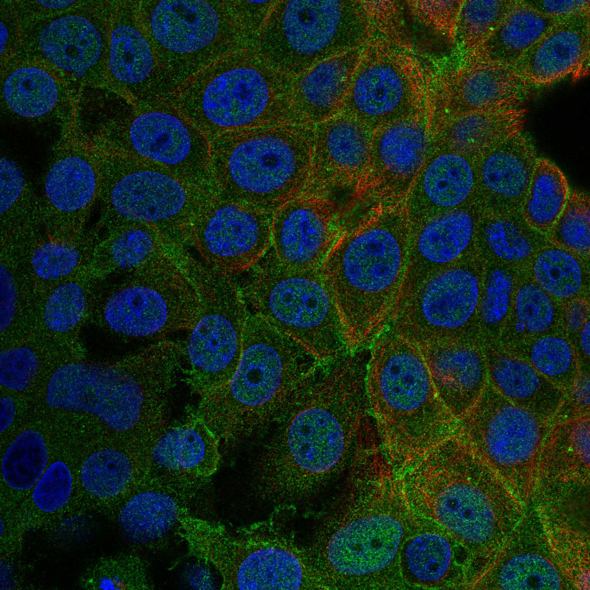 HSBP1 fluorescence