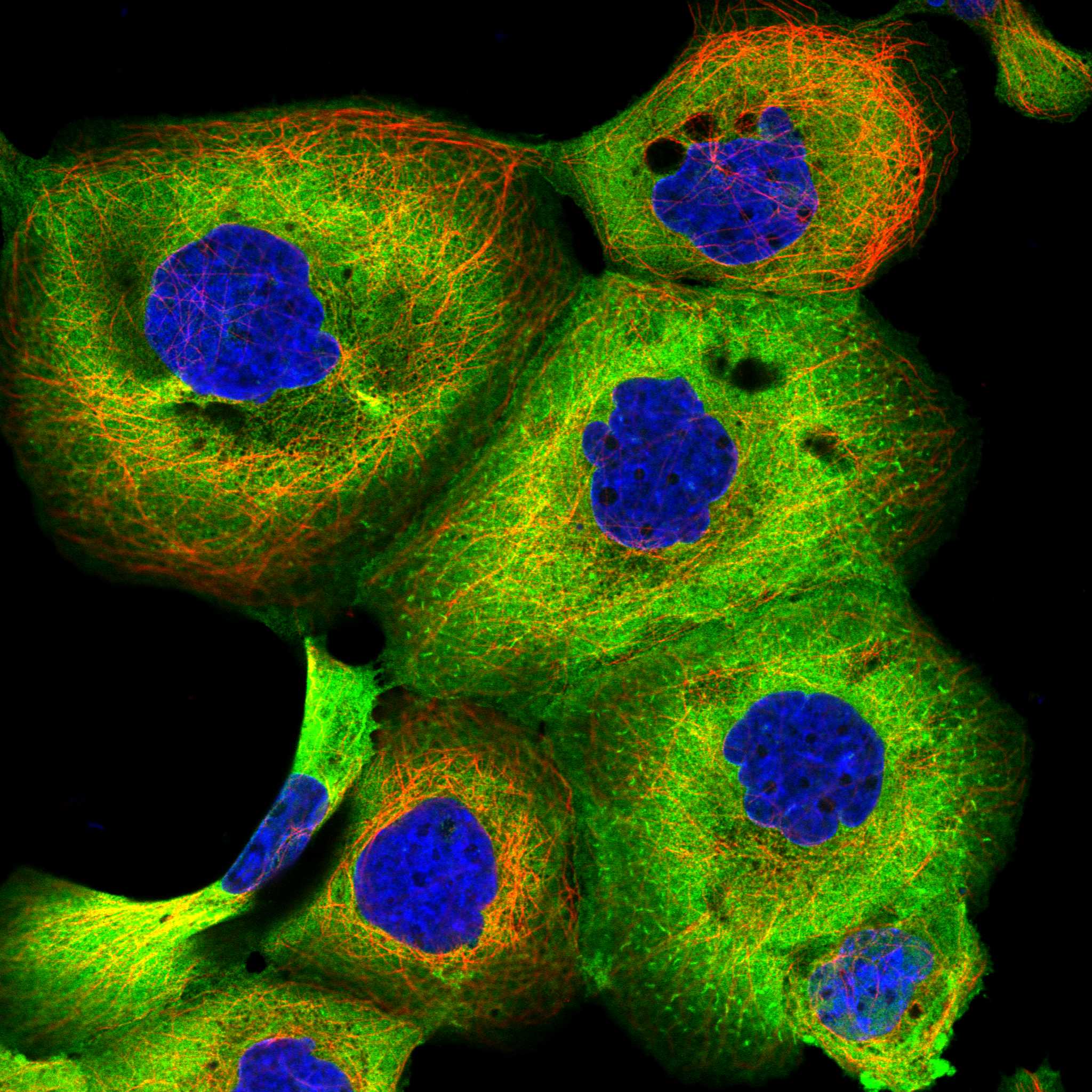 HSPB1 fluorescence