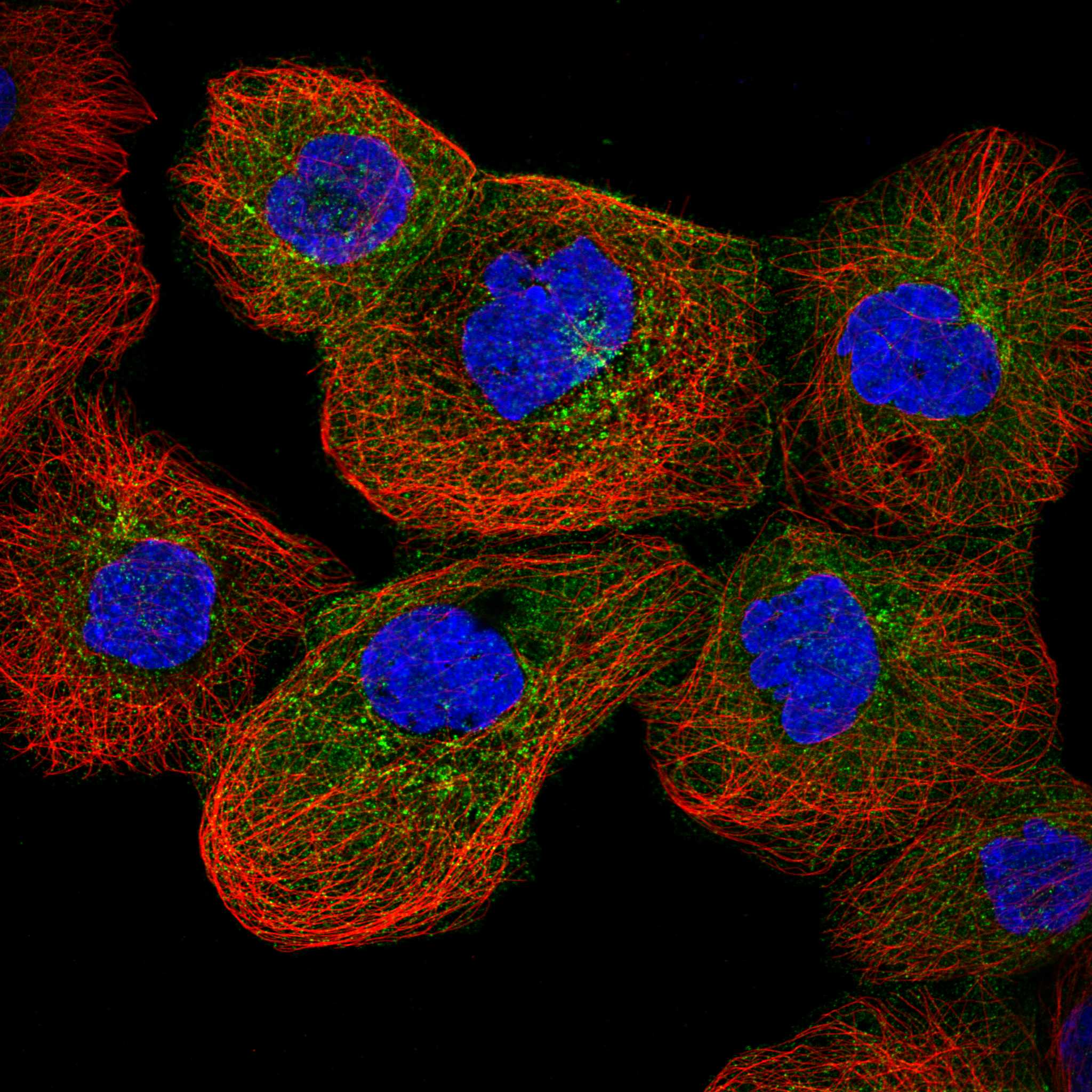 IFIT5 fluorescence
