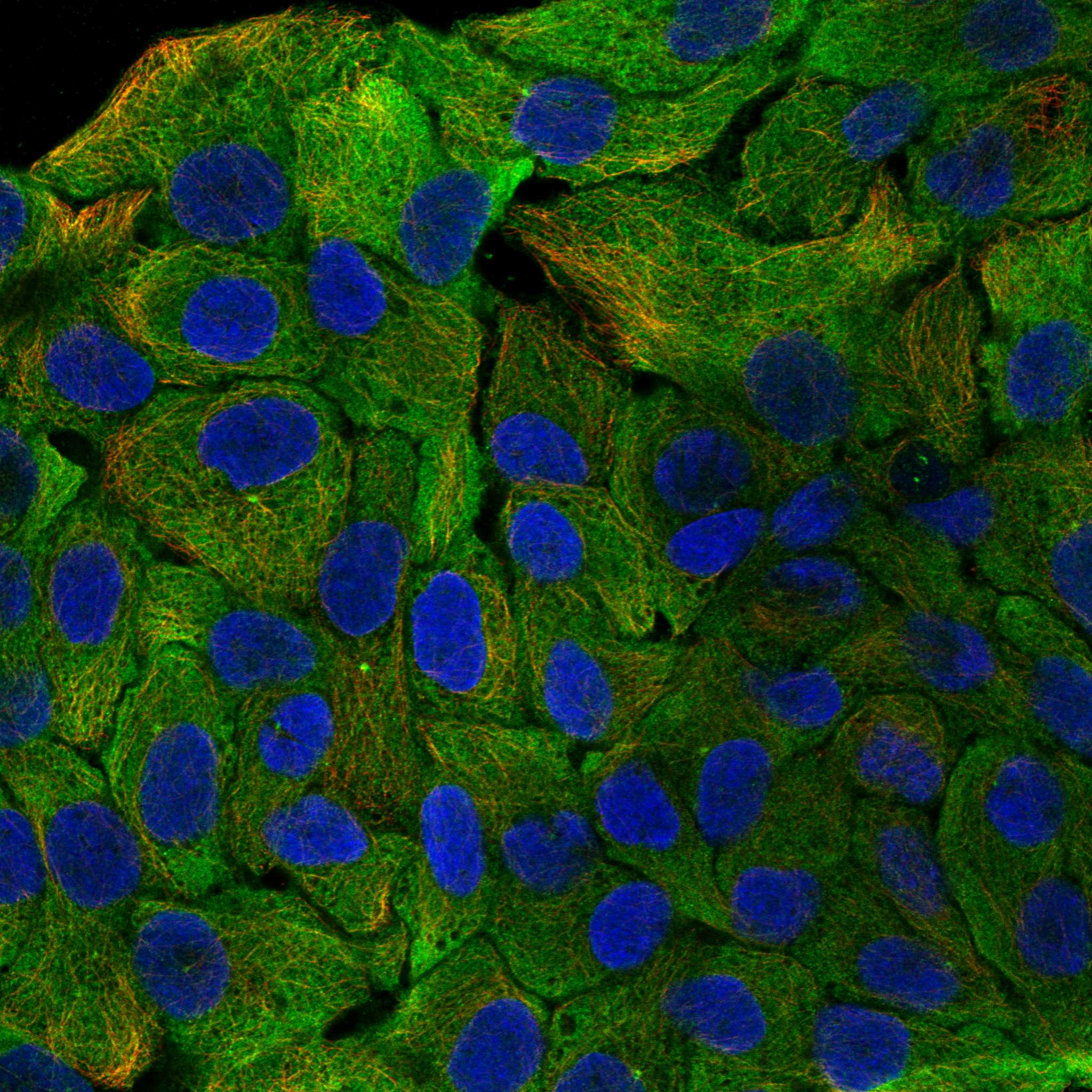 IMPG1 fluorescence