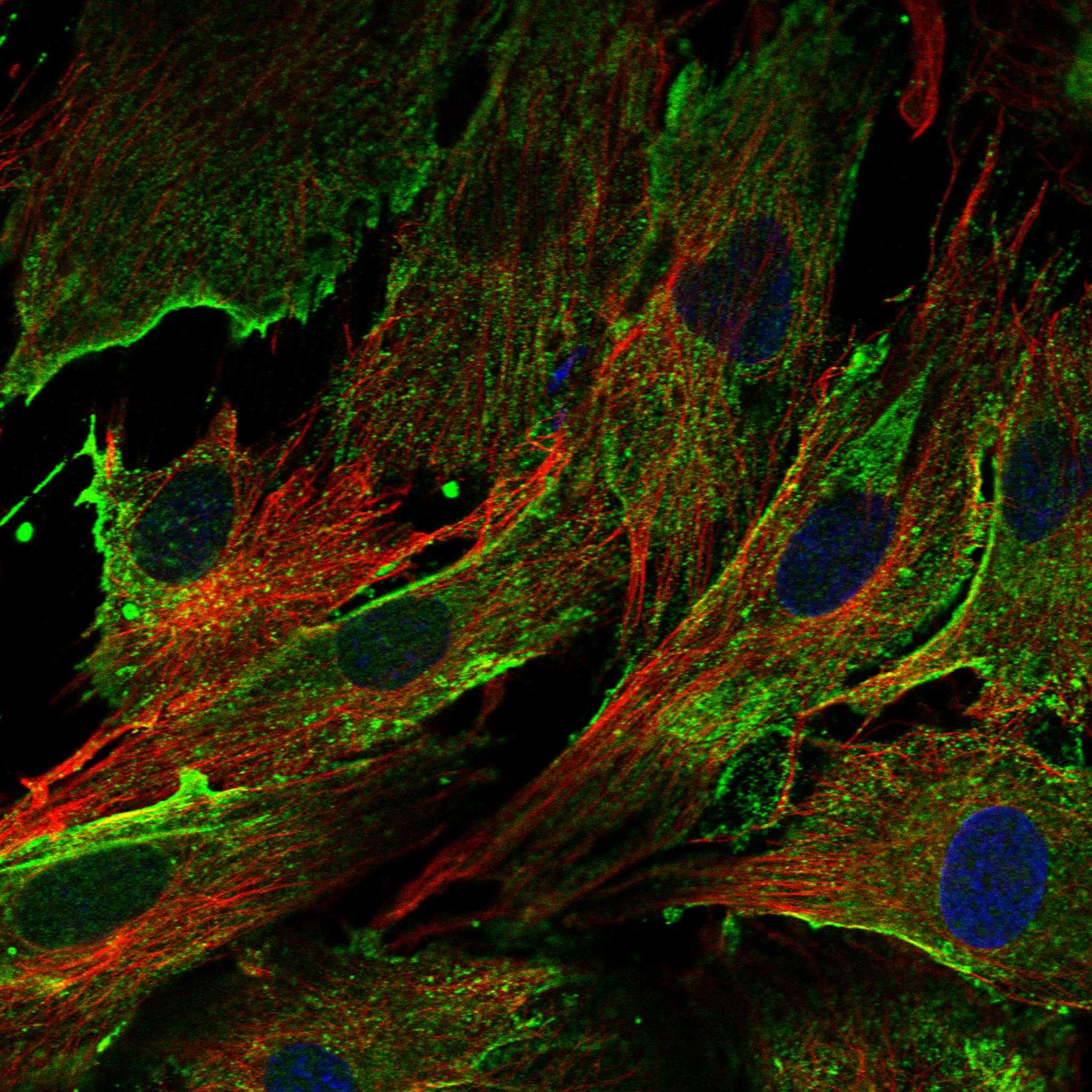 ISLR fluorescence