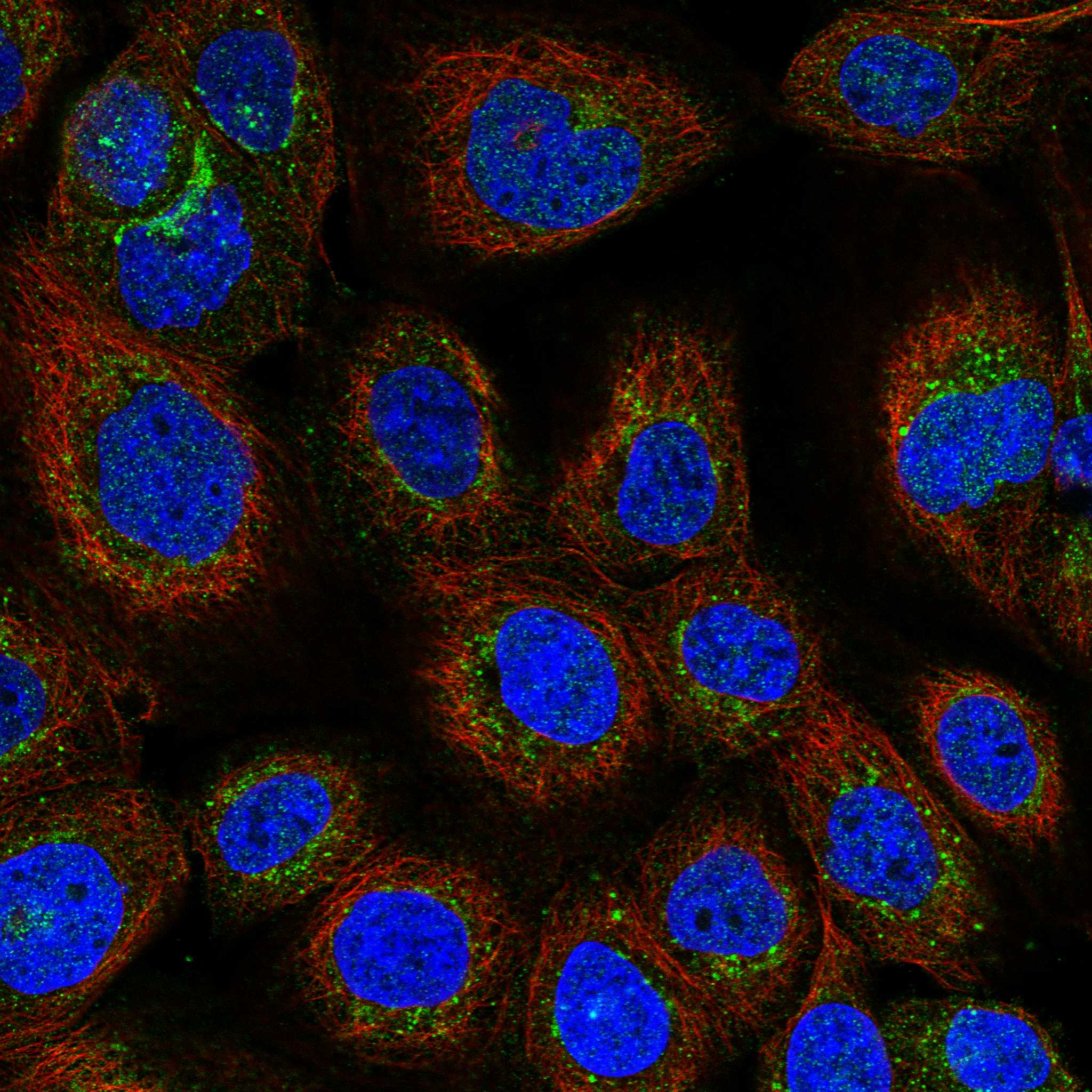 ITM2B fluorescence
