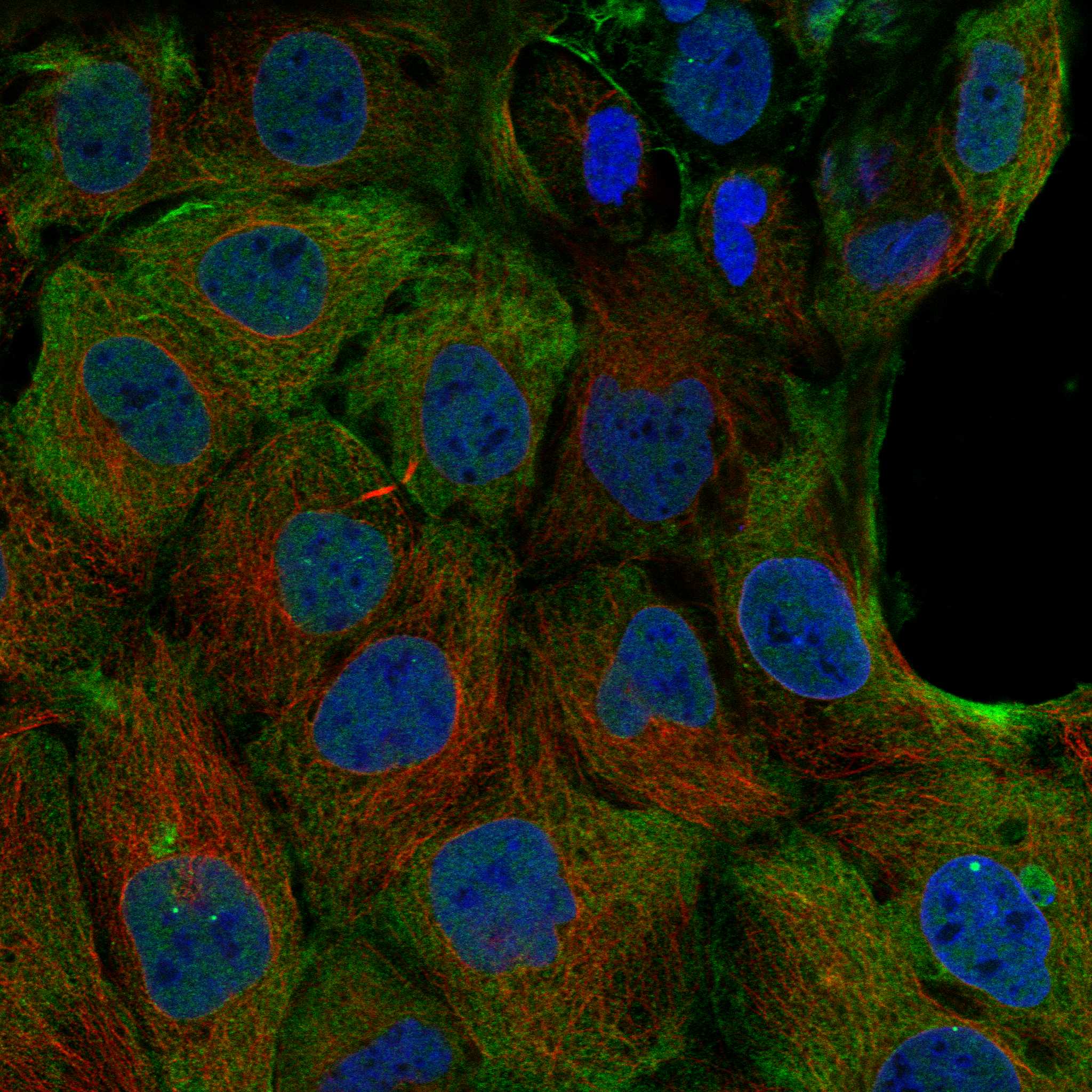 JAML fluorescence