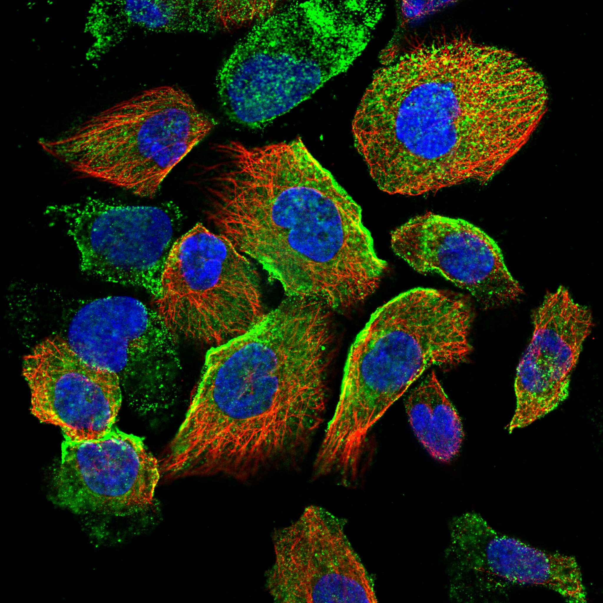 JMJD4 fluorescence