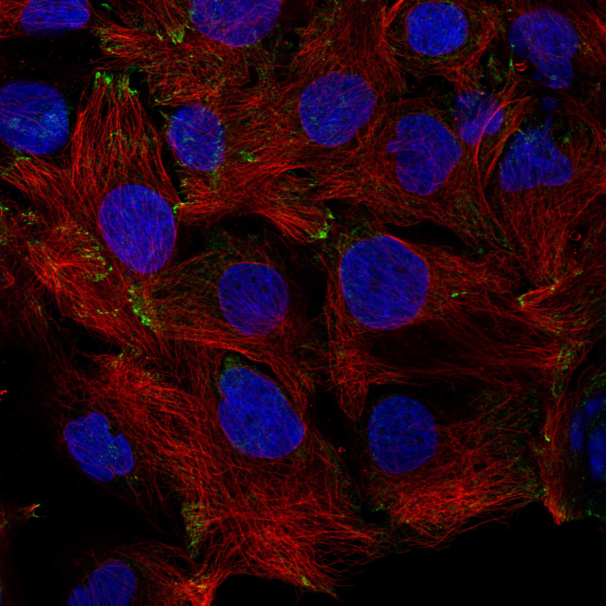 KANK1 fluorescence