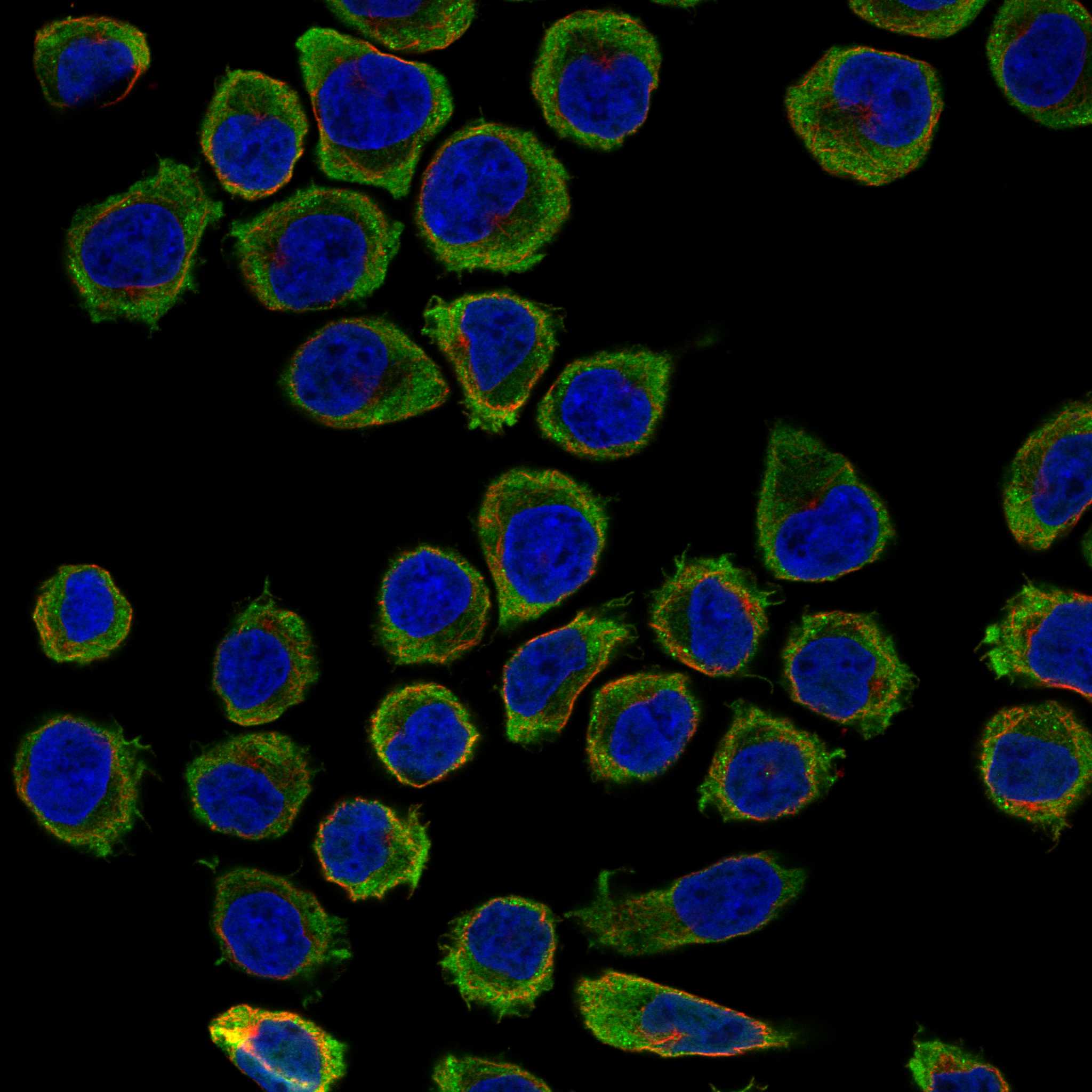KCNE3 fluorescence