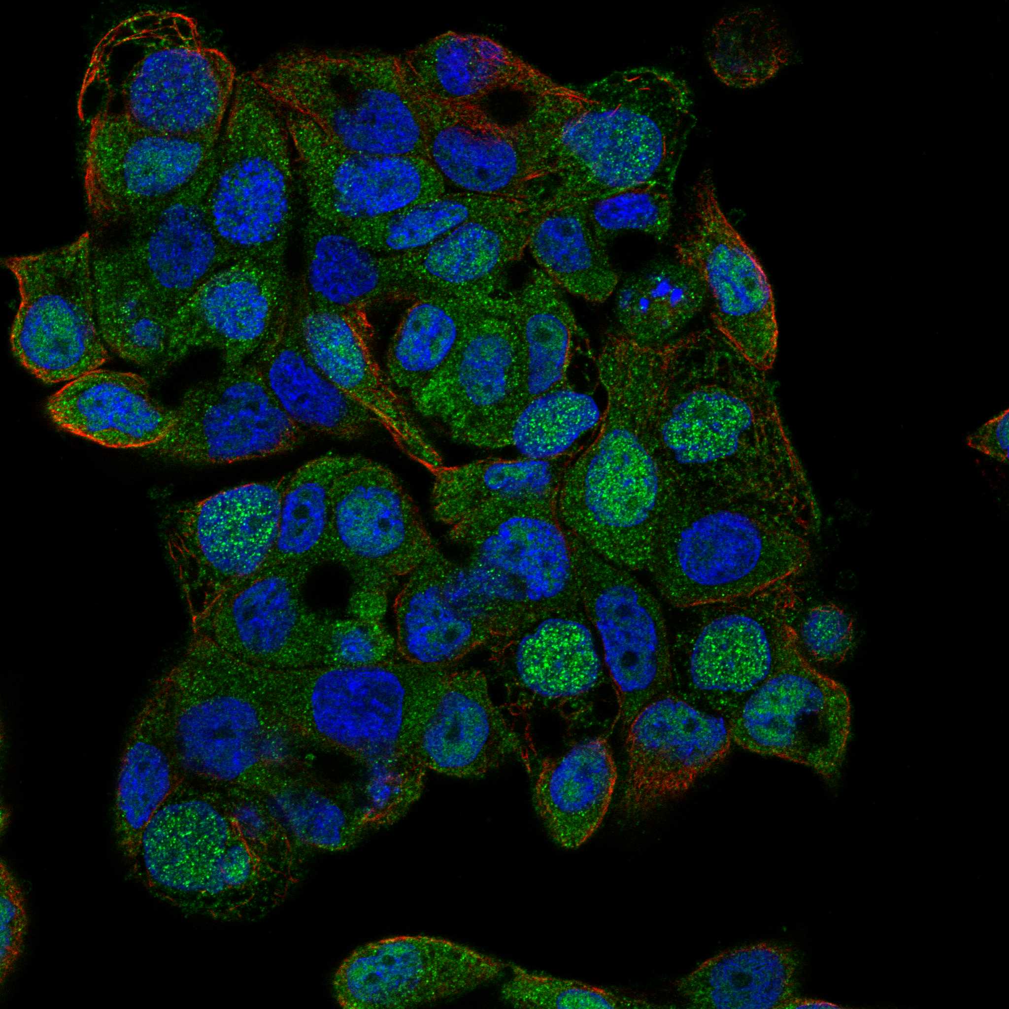 KCNT1 fluorescence