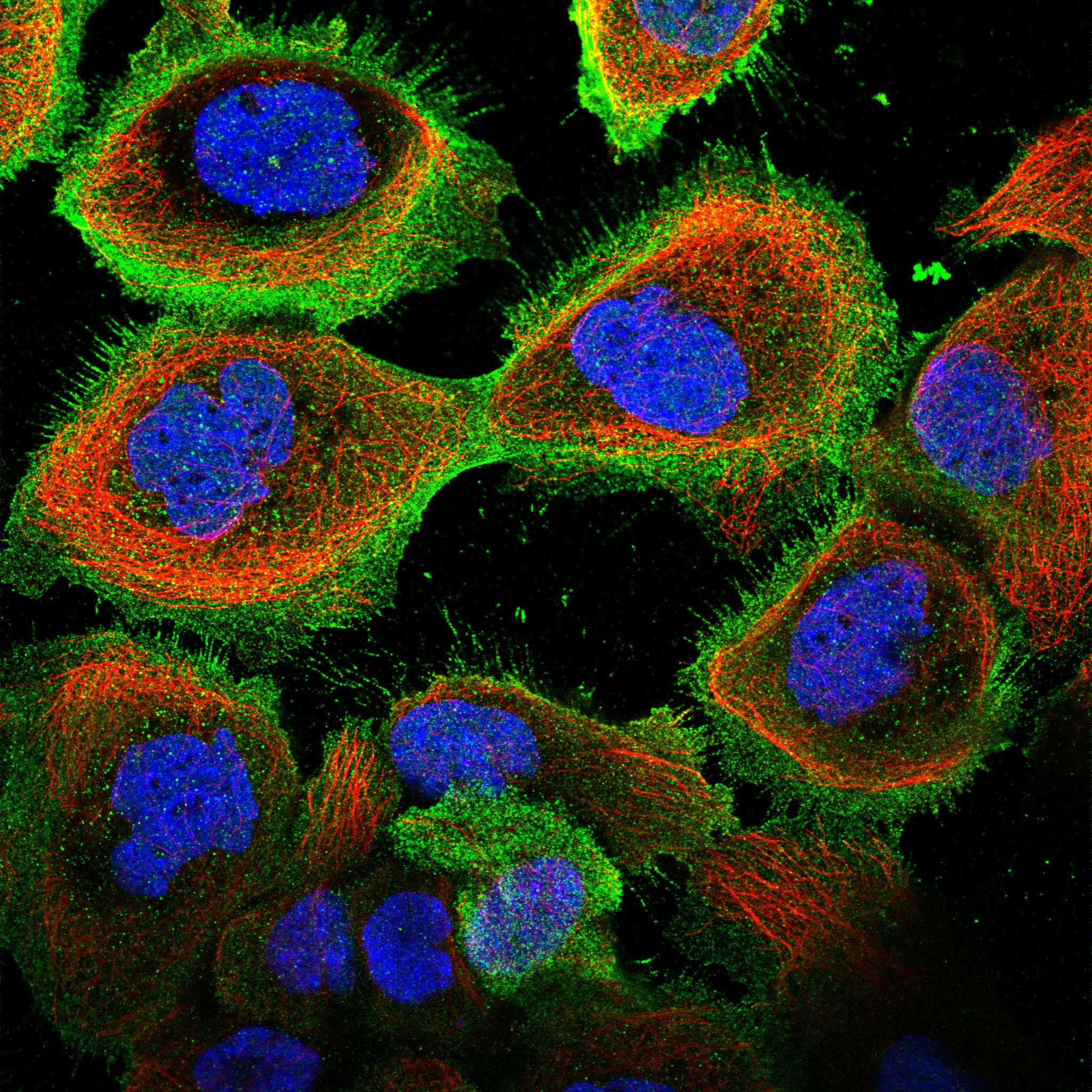 KIF19 fluorescence
