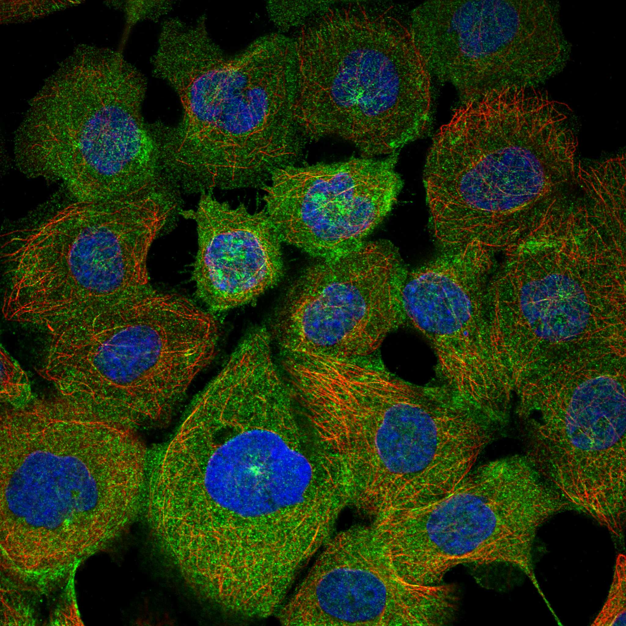 KLHL6 fluorescence