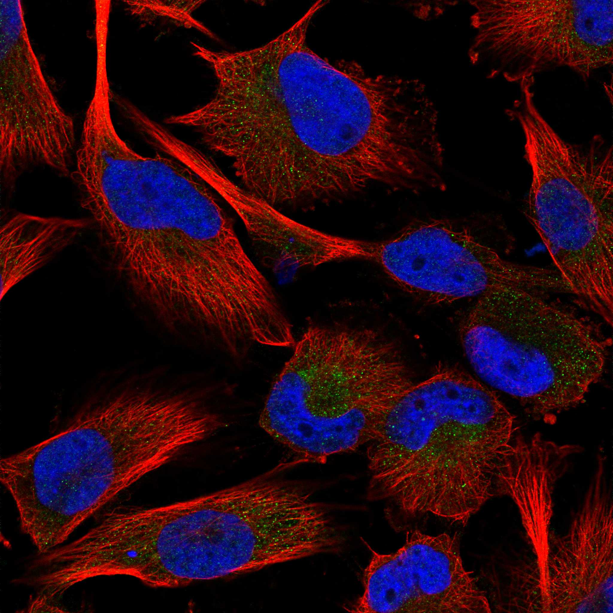 LAMP2 fluorescence