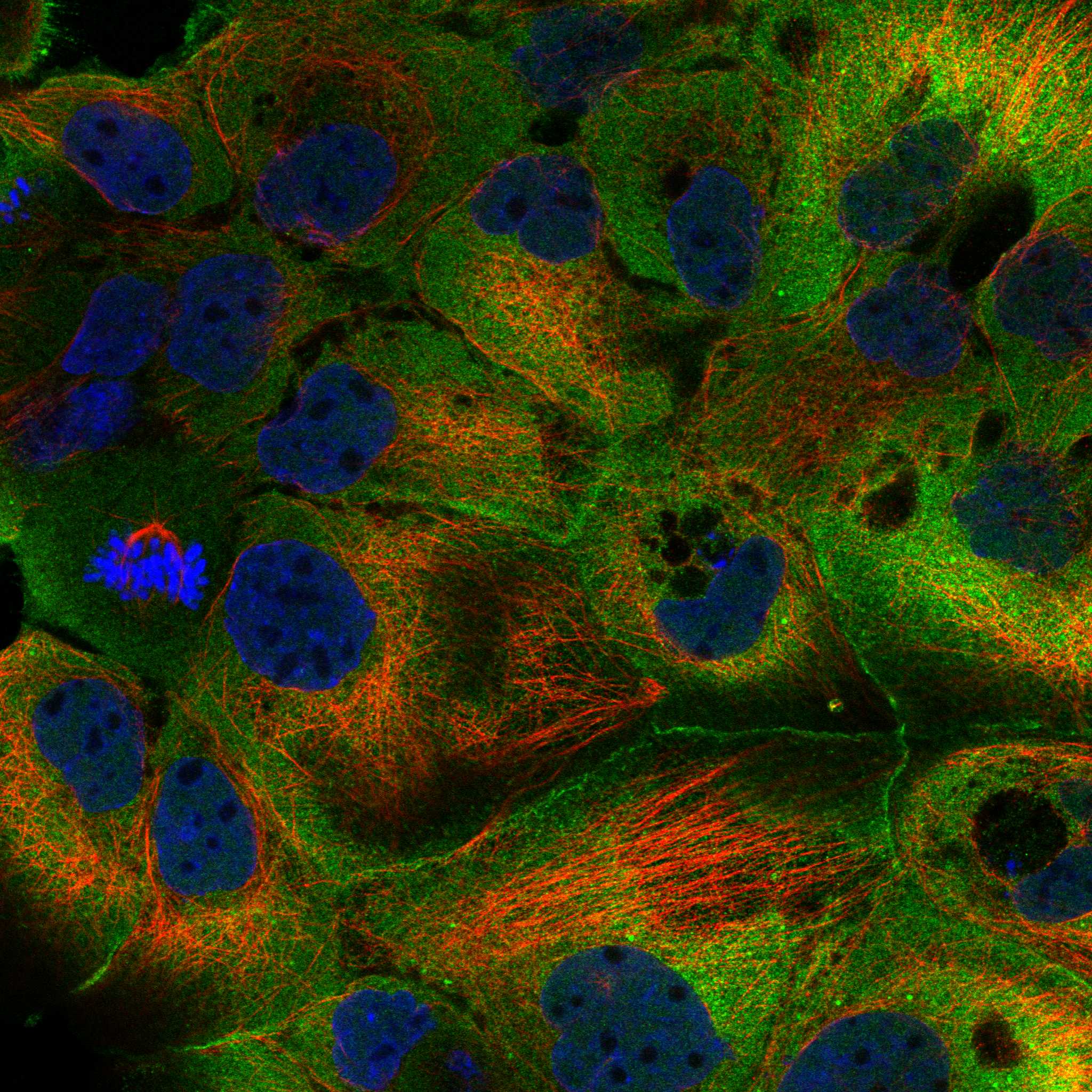 LEMD1 fluorescence