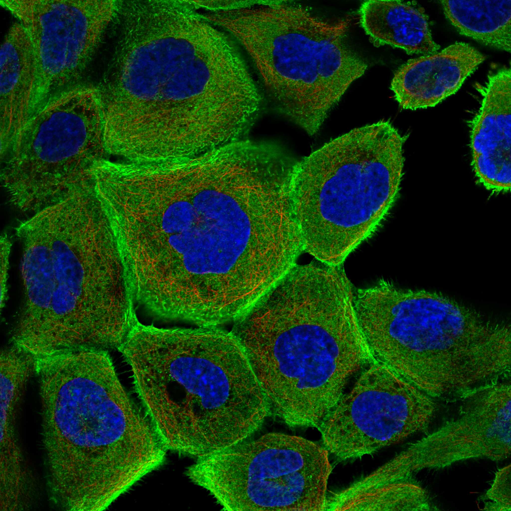 LIMA1 fluorescence