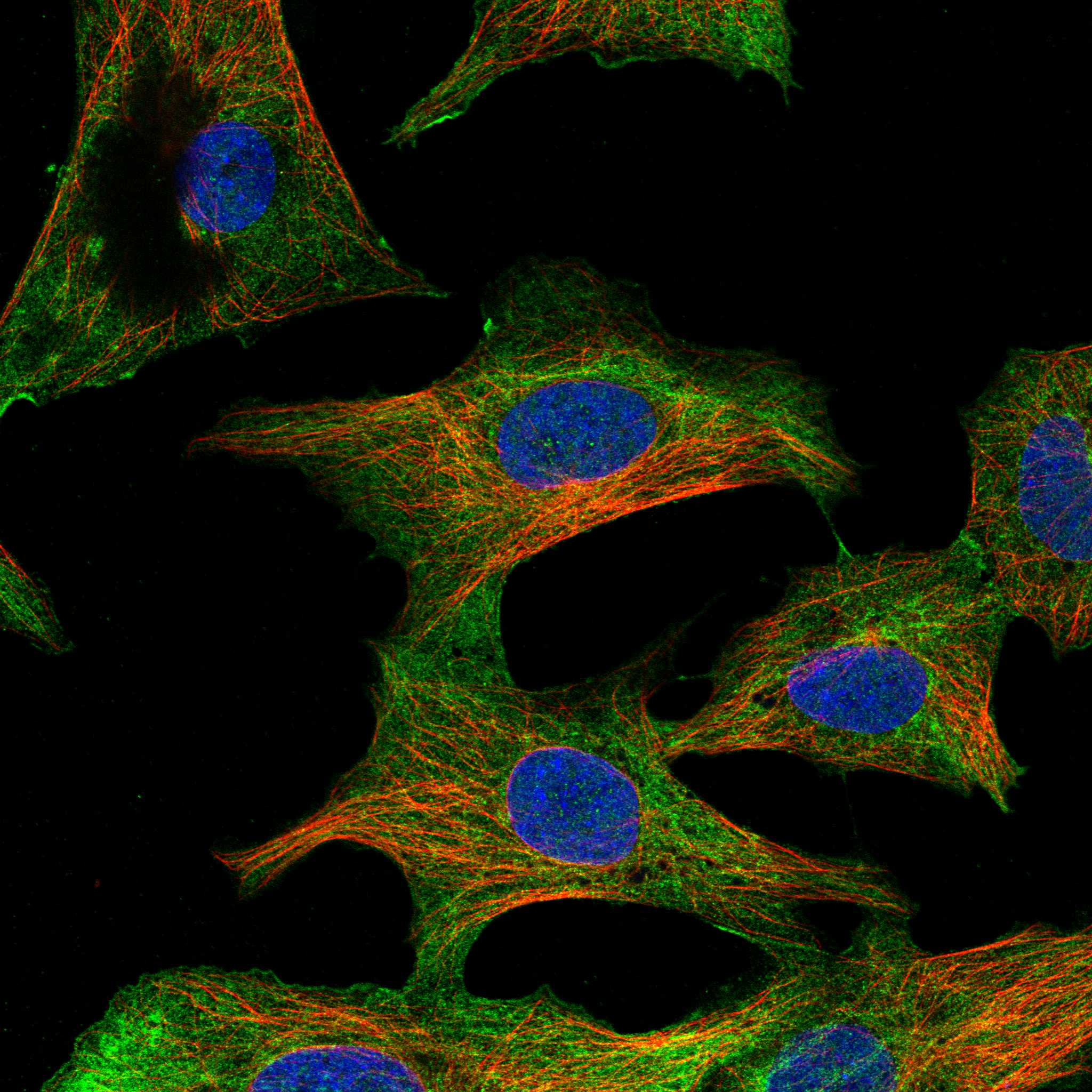 LMOD2 fluorescence