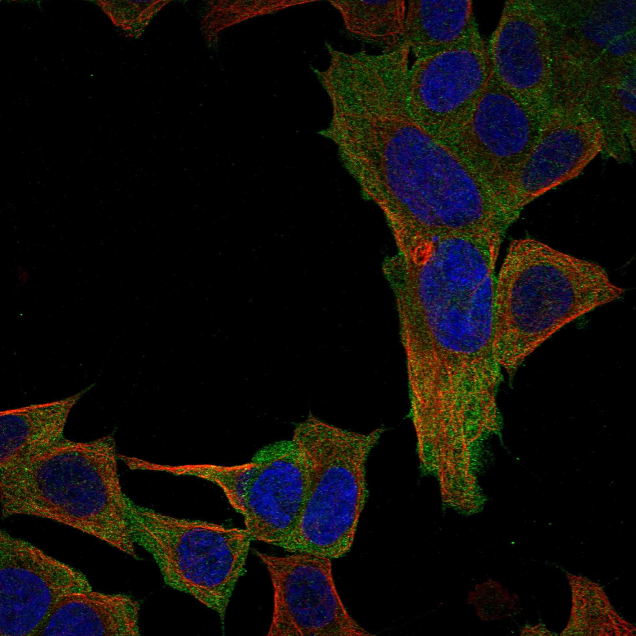 LRCH2 fluorescence