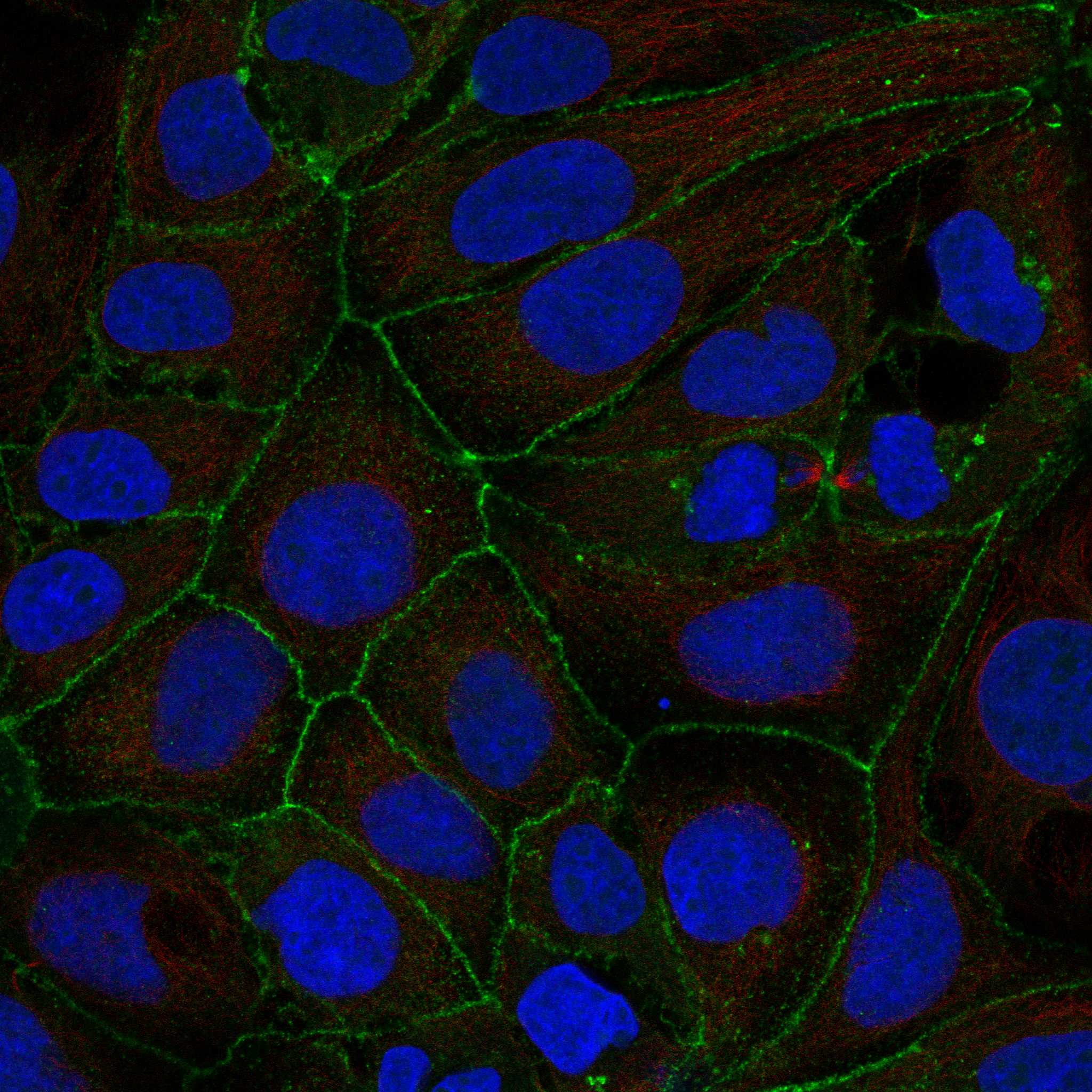 LSR fluorescence