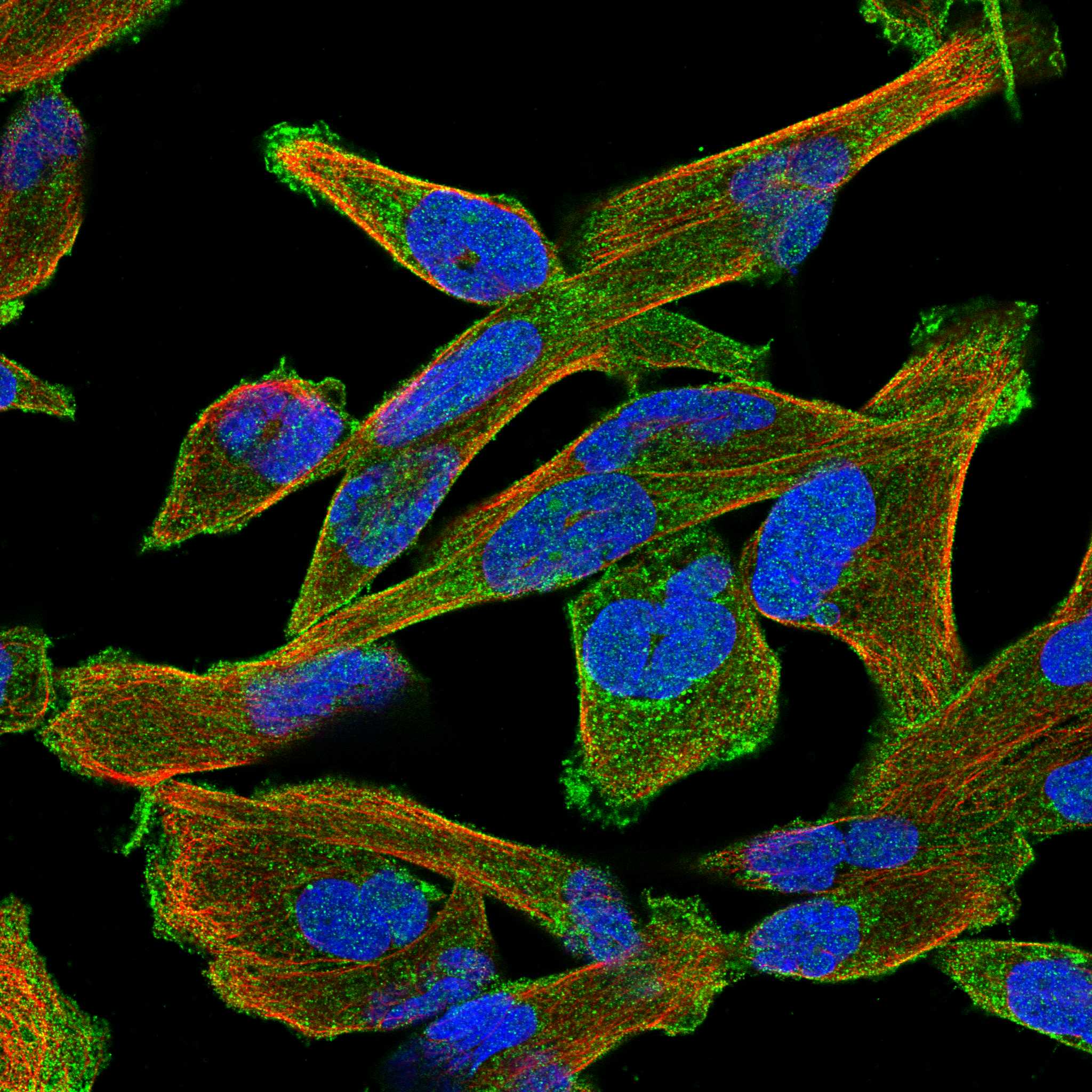 LZTS1 fluorescence