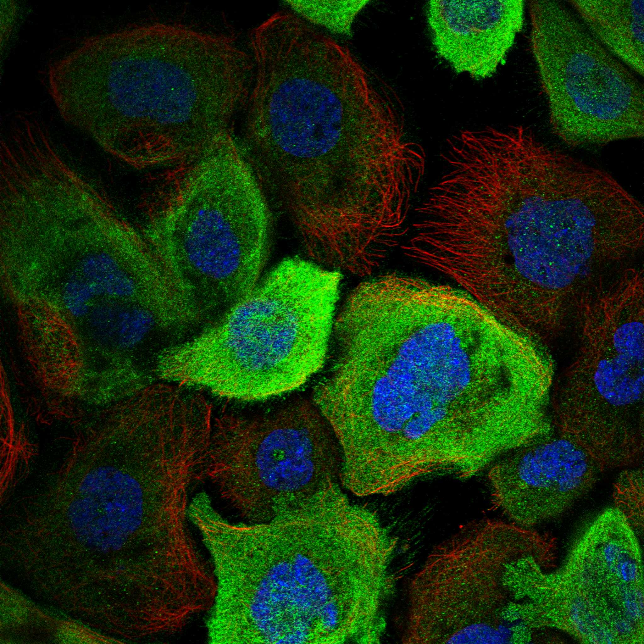 LZTS2 fluorescence