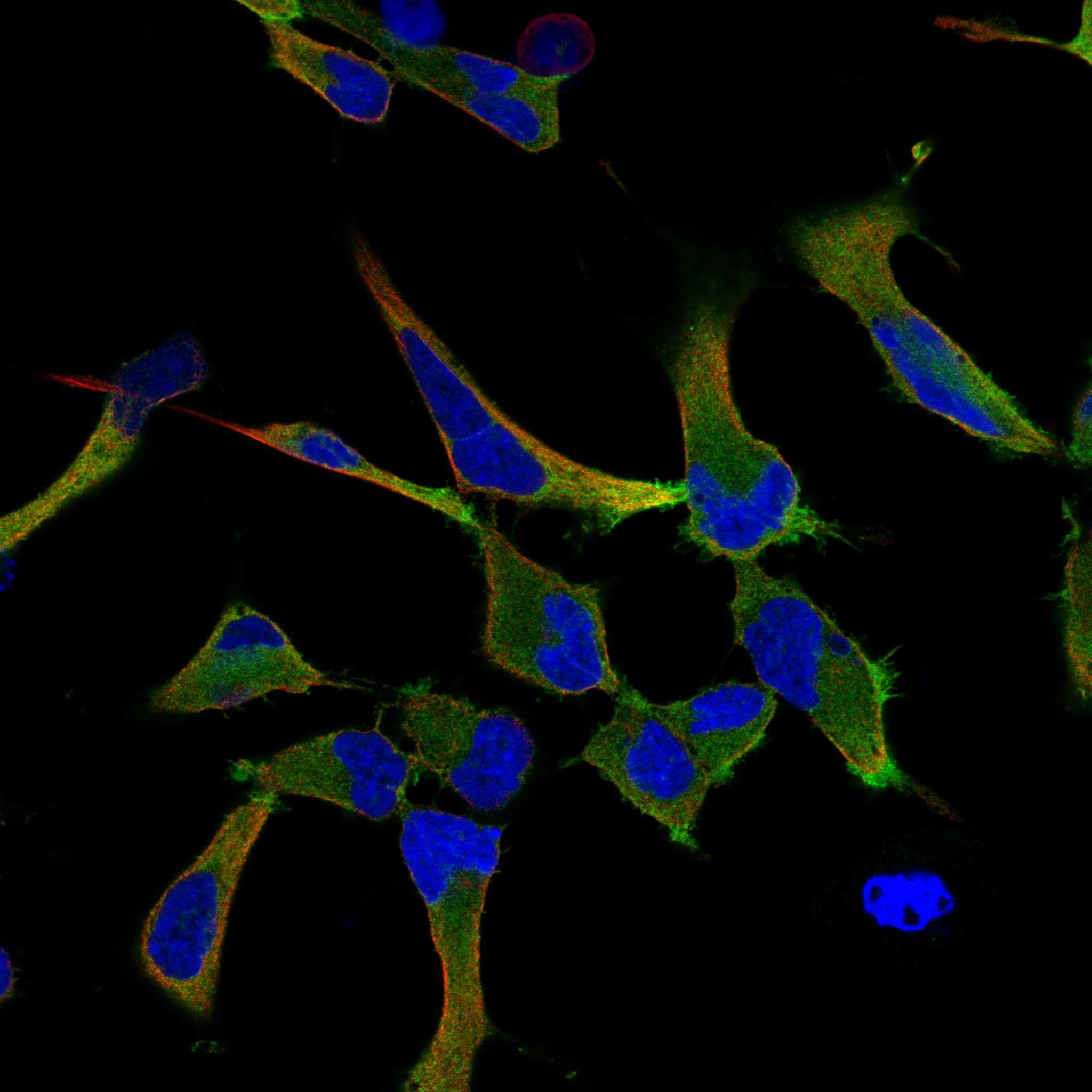 MAP2 fluorescence