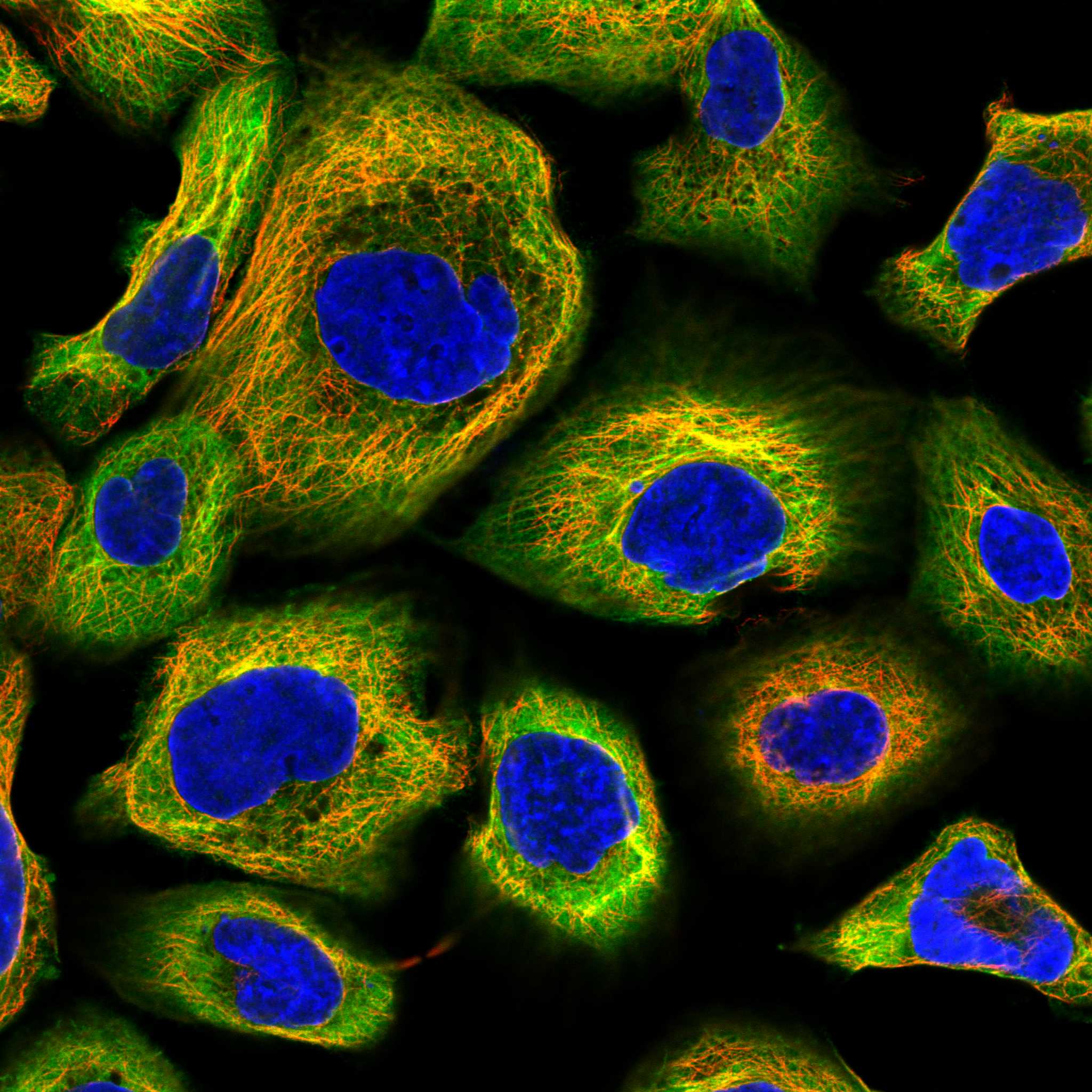 MAP4 fluorescence