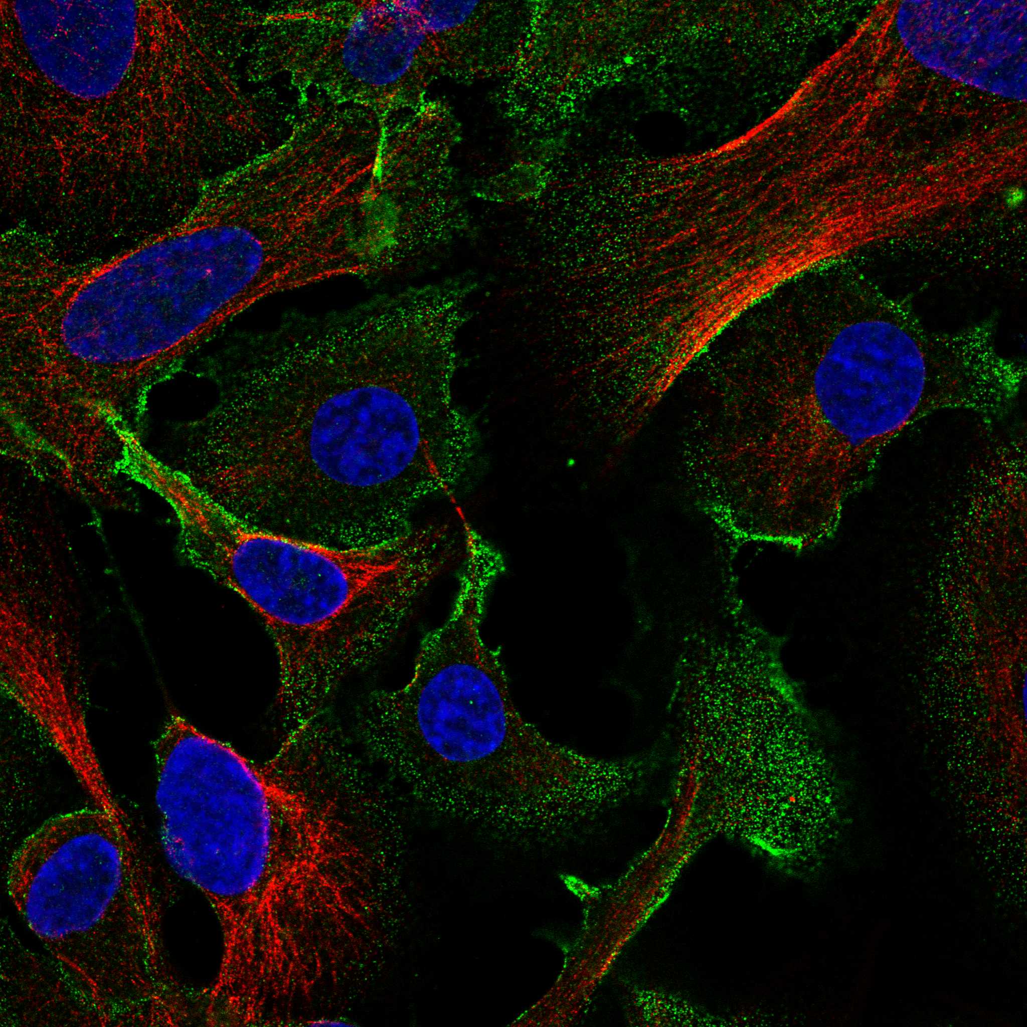 MAT2B fluorescence