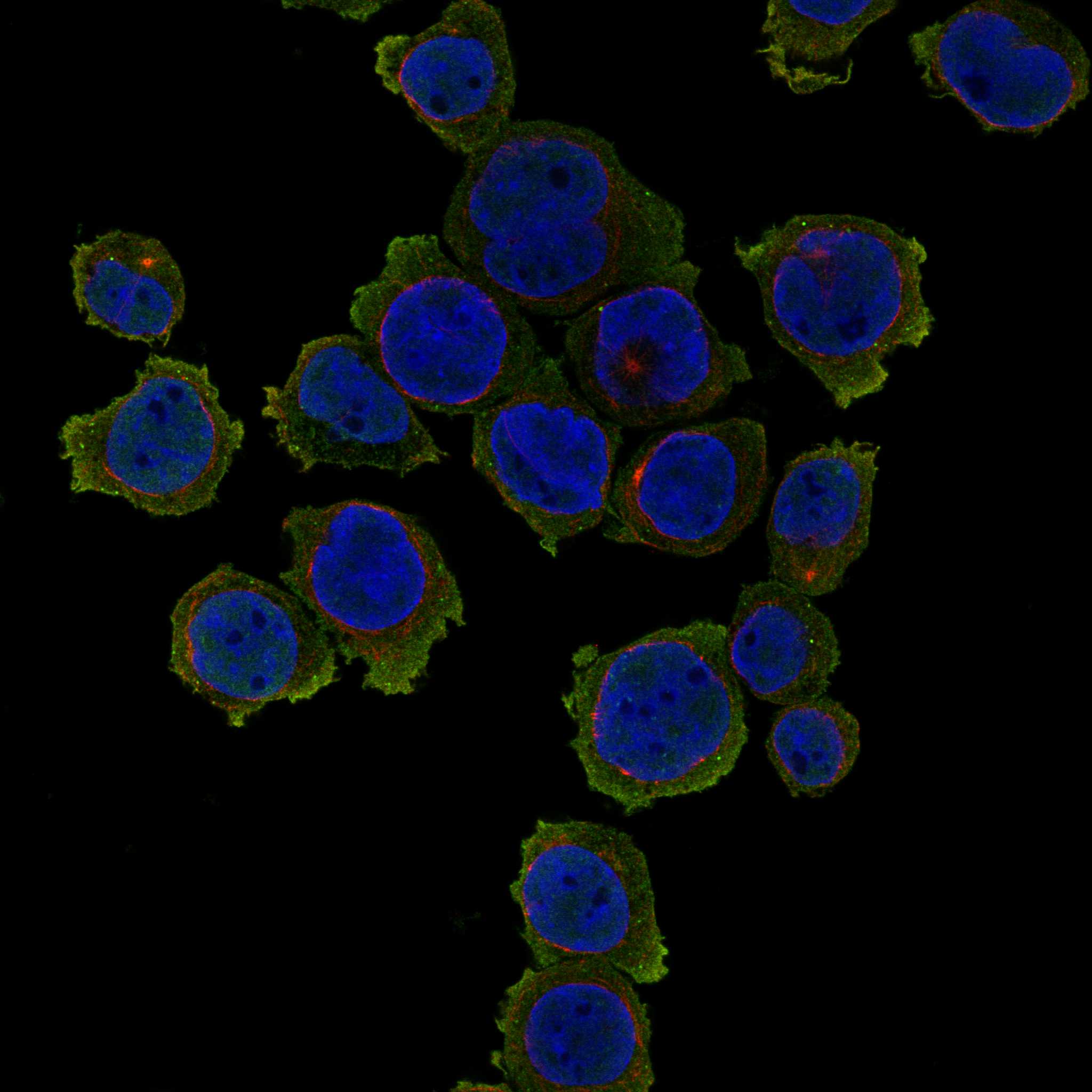 MEFV fluorescence