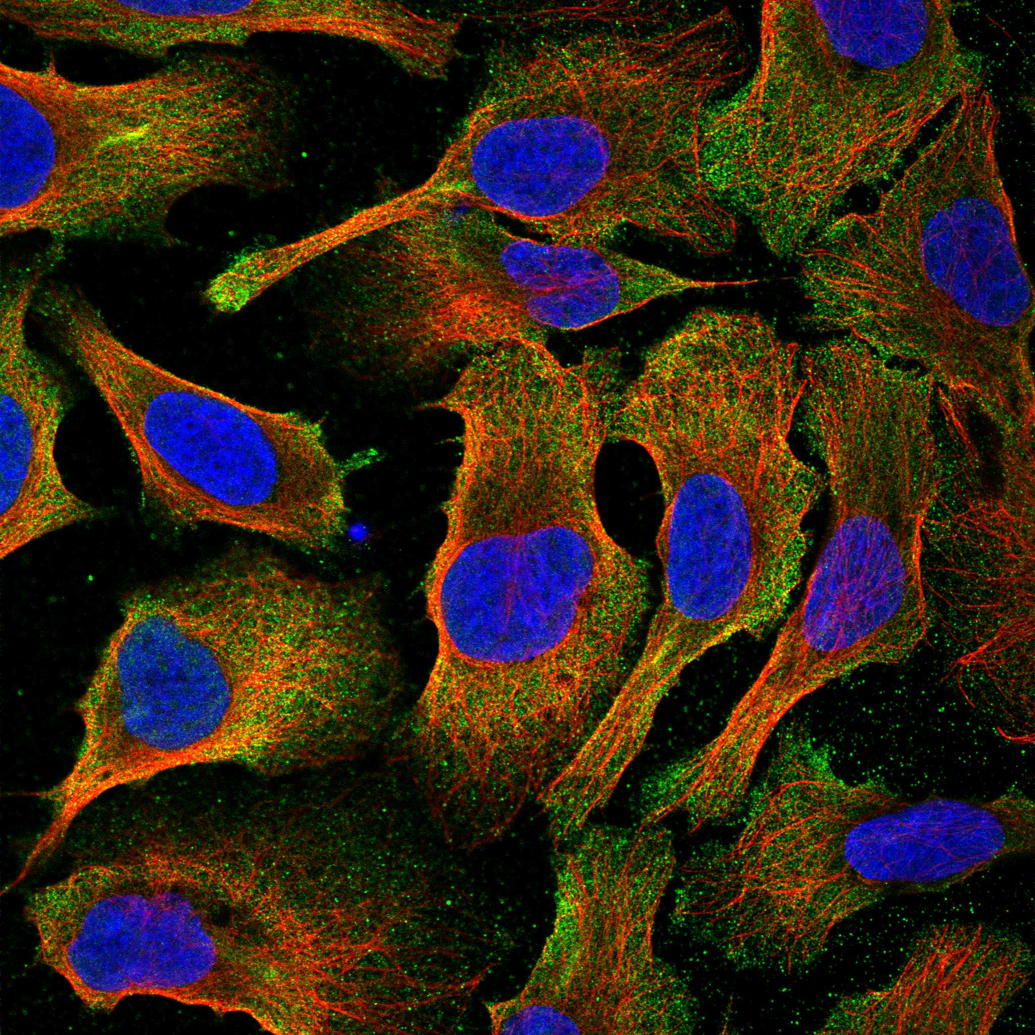 MMP15 fluorescence