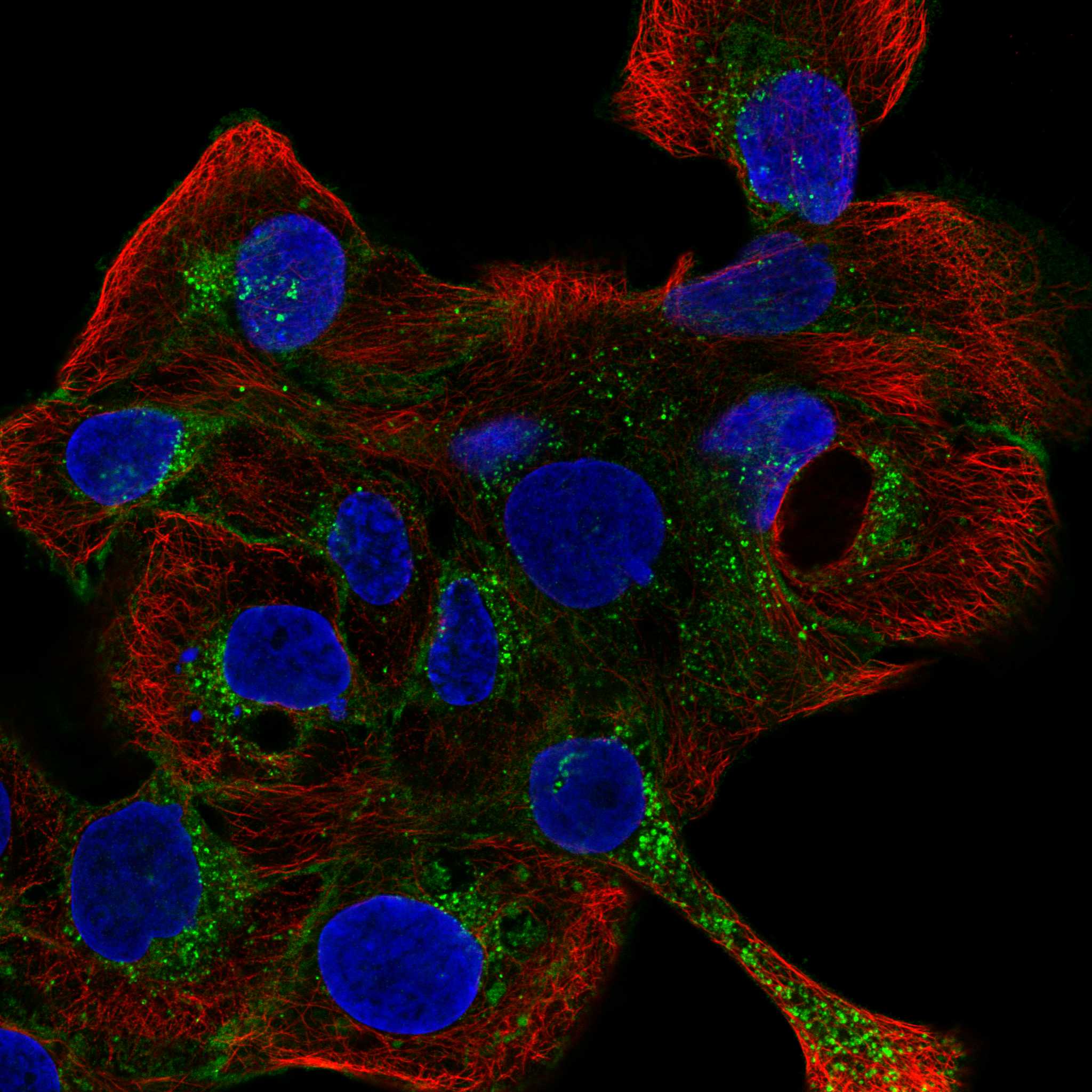 MPZL1 fluorescence