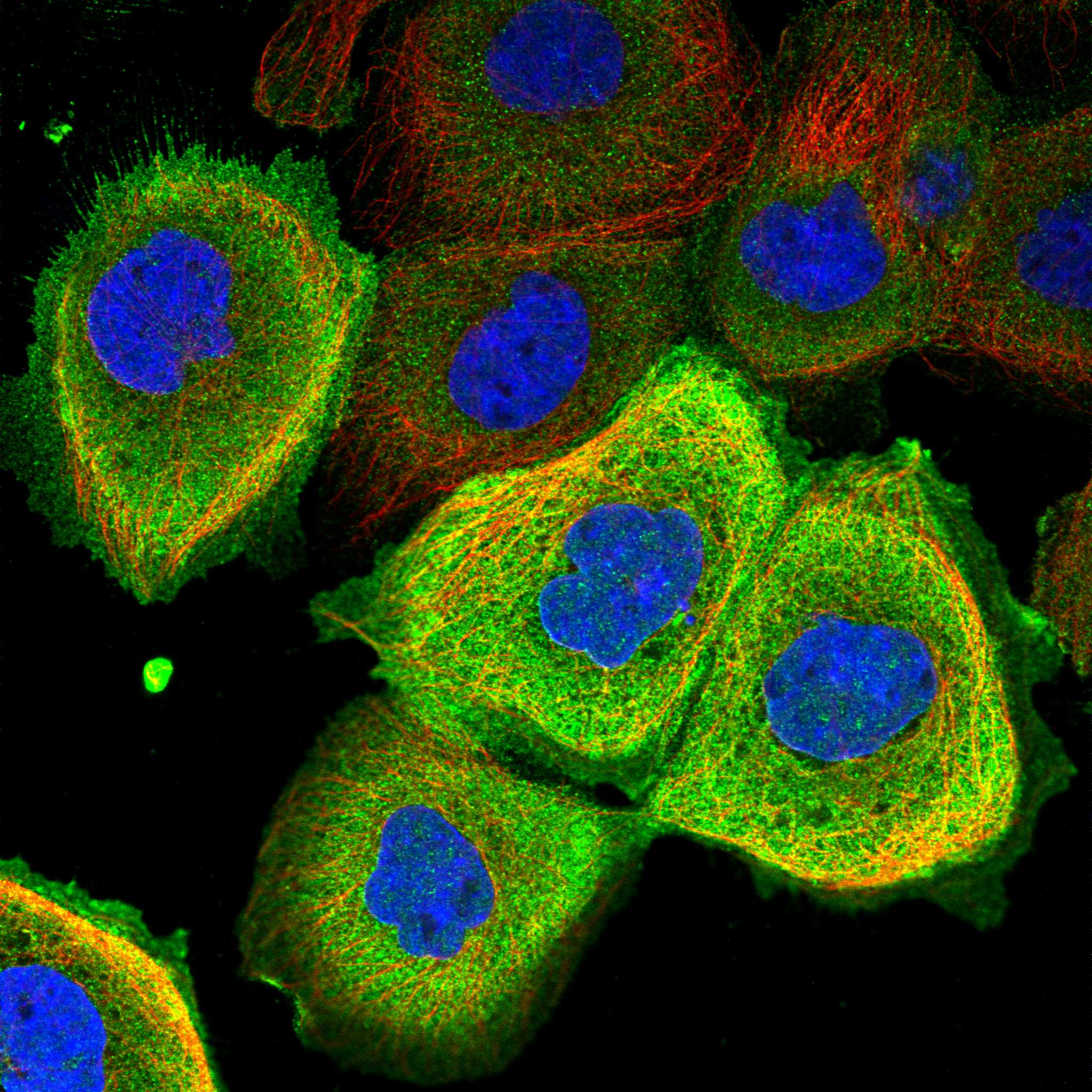 MRNIP fluorescence