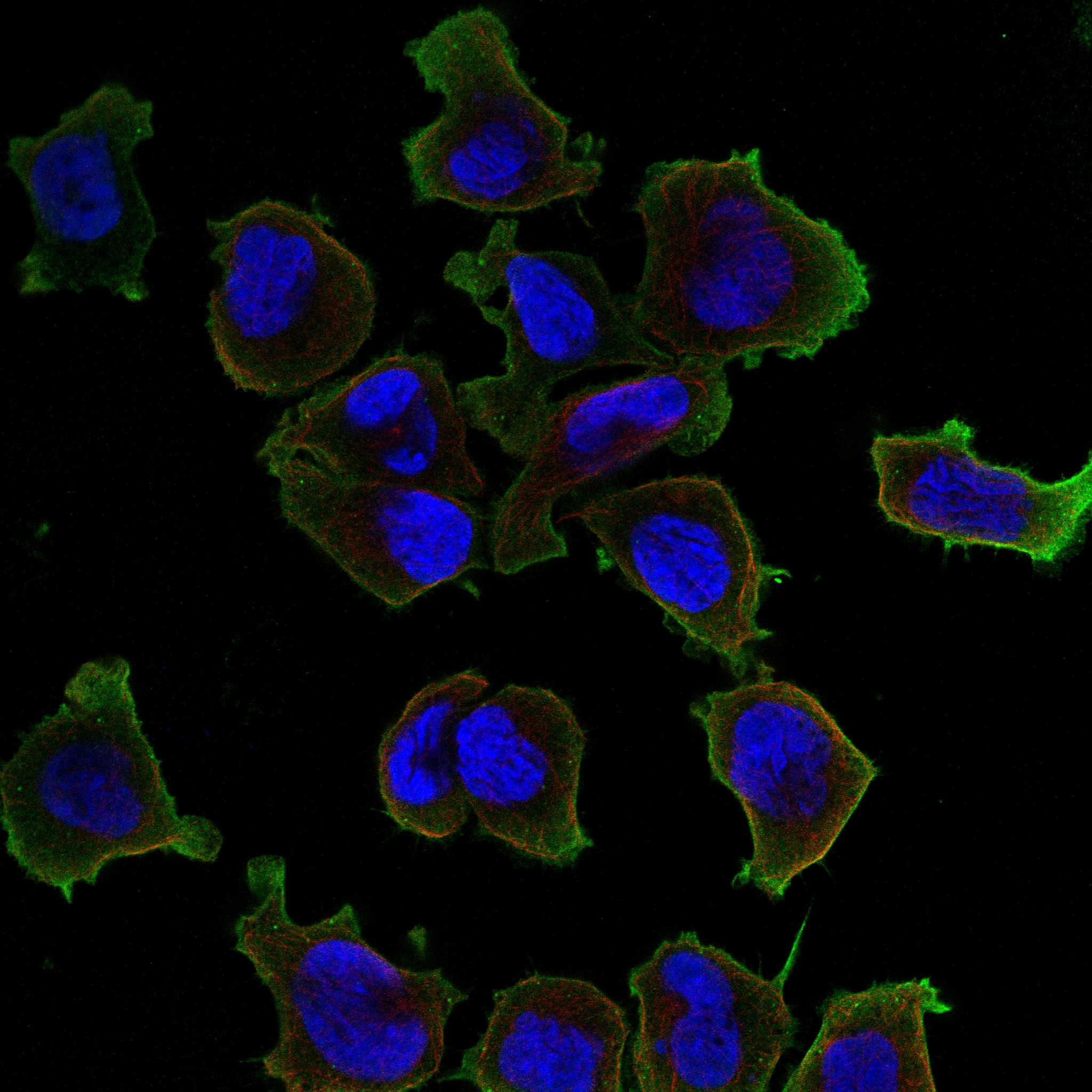 MSLN fluorescence