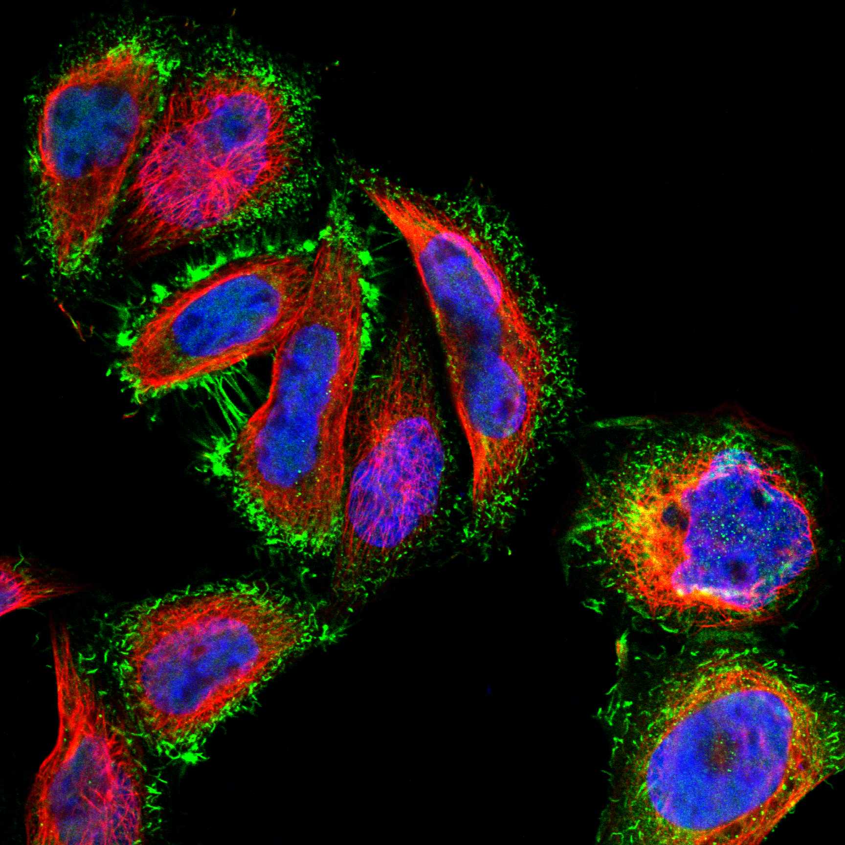 MTM1 fluorescence