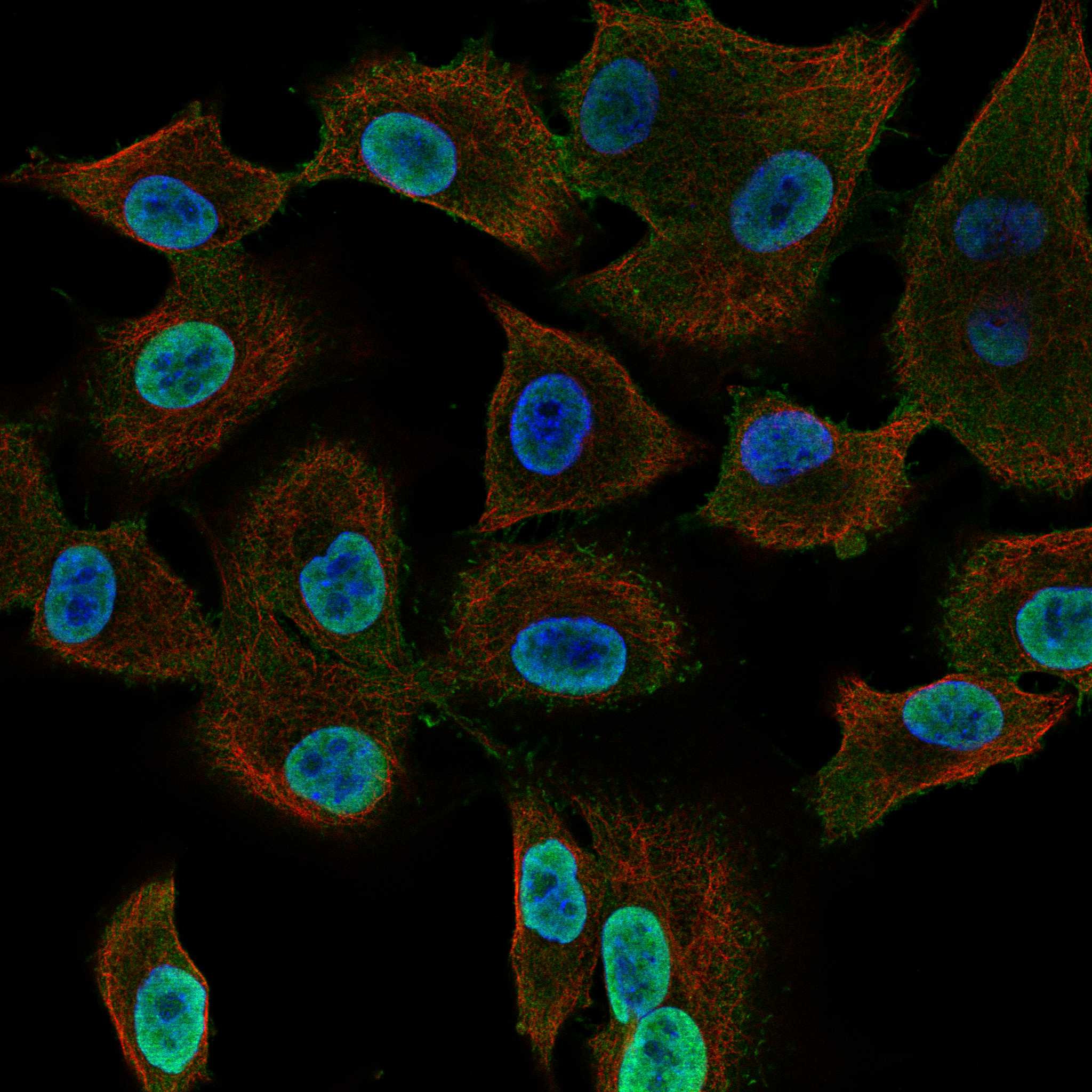 MYO1E fluorescence