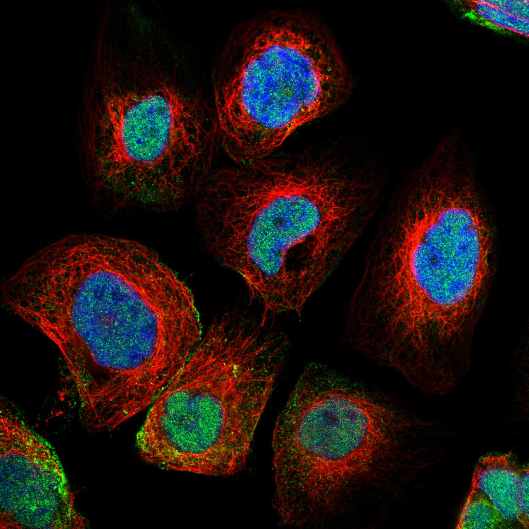 NAB1 fluorescence